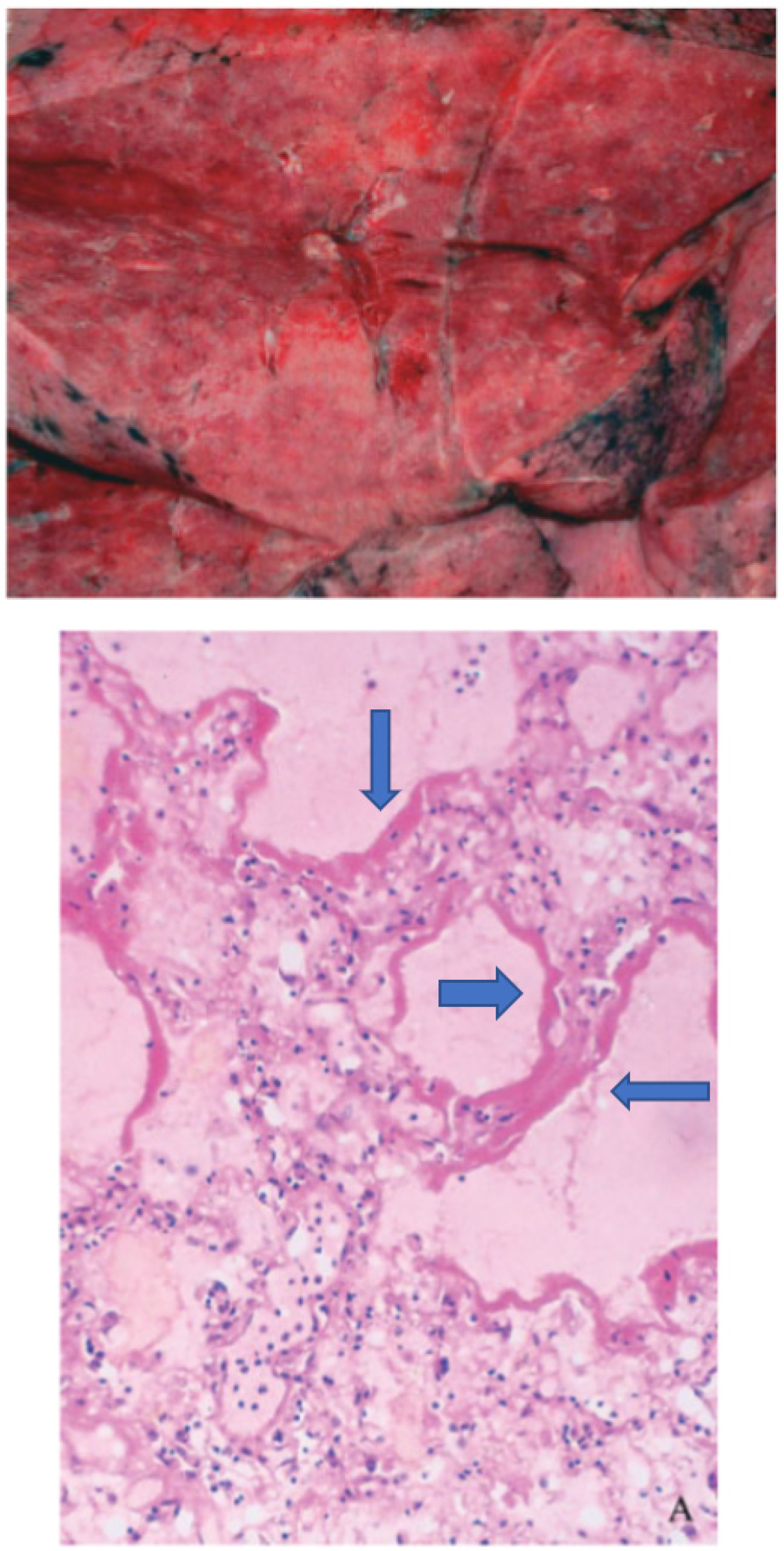 Medsci 10 00058 g002