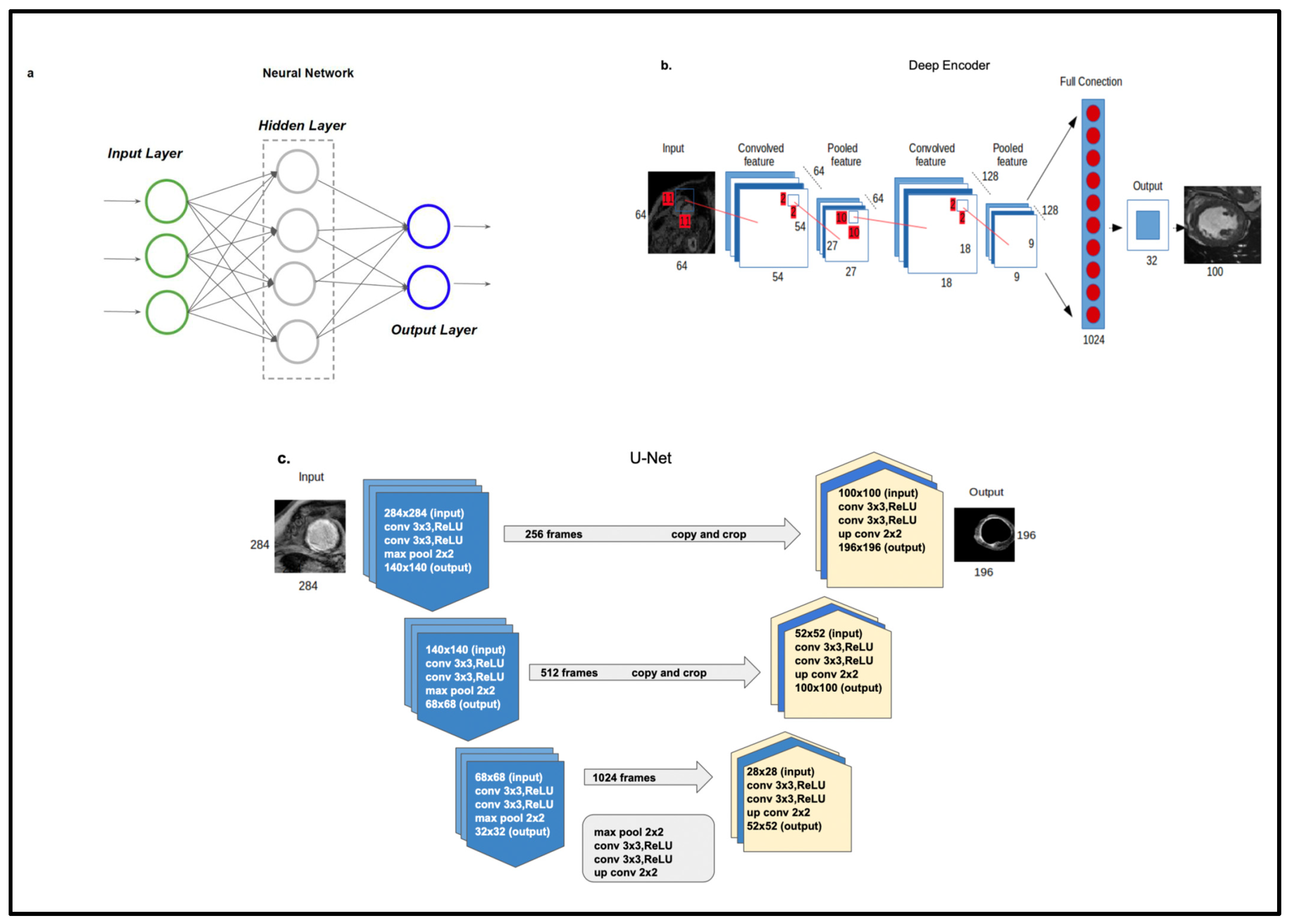 AI-powered interpretable imaging phenotypes noninvasively