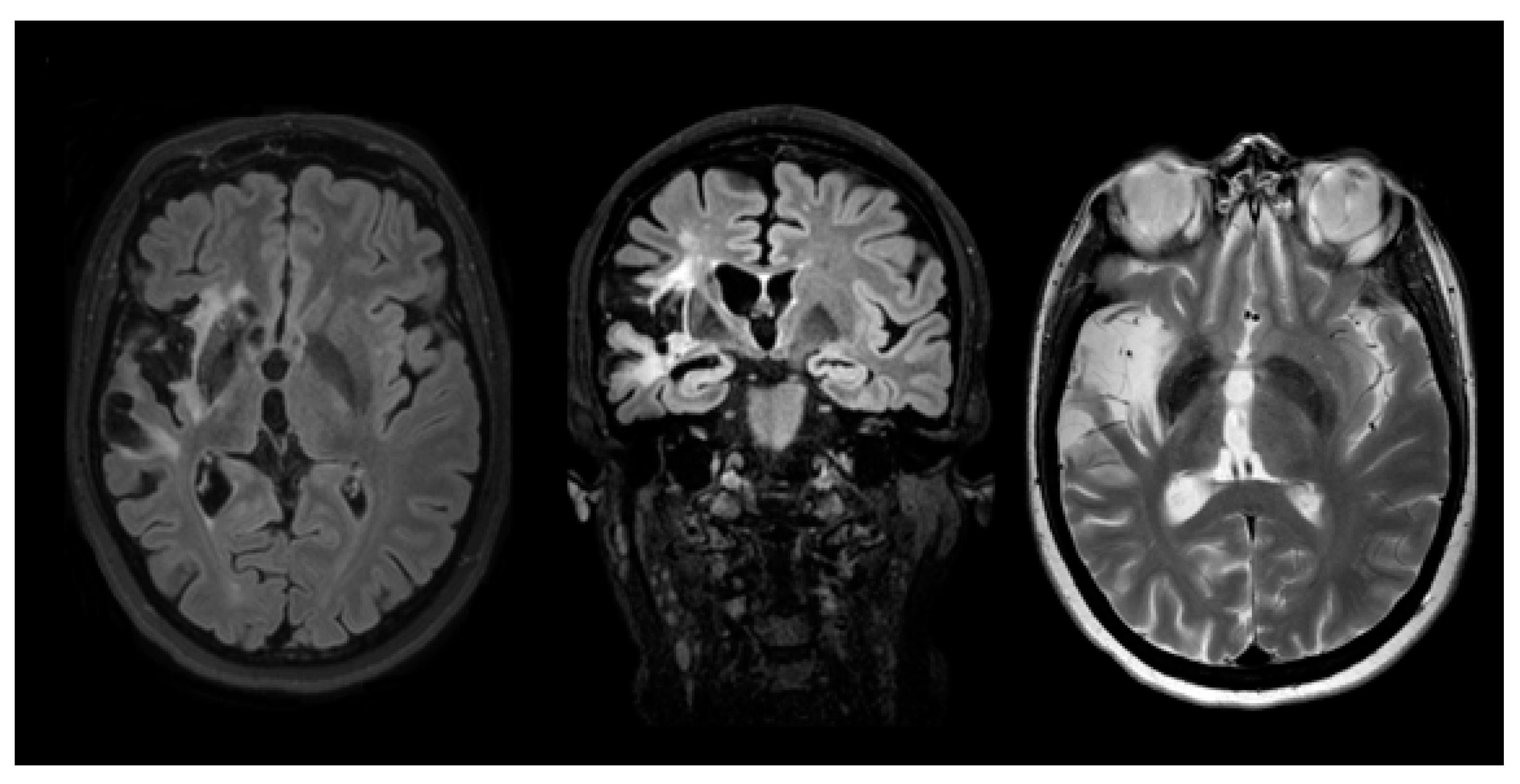 Medsci 11 00034 g002 Medsci 11 00034 g002