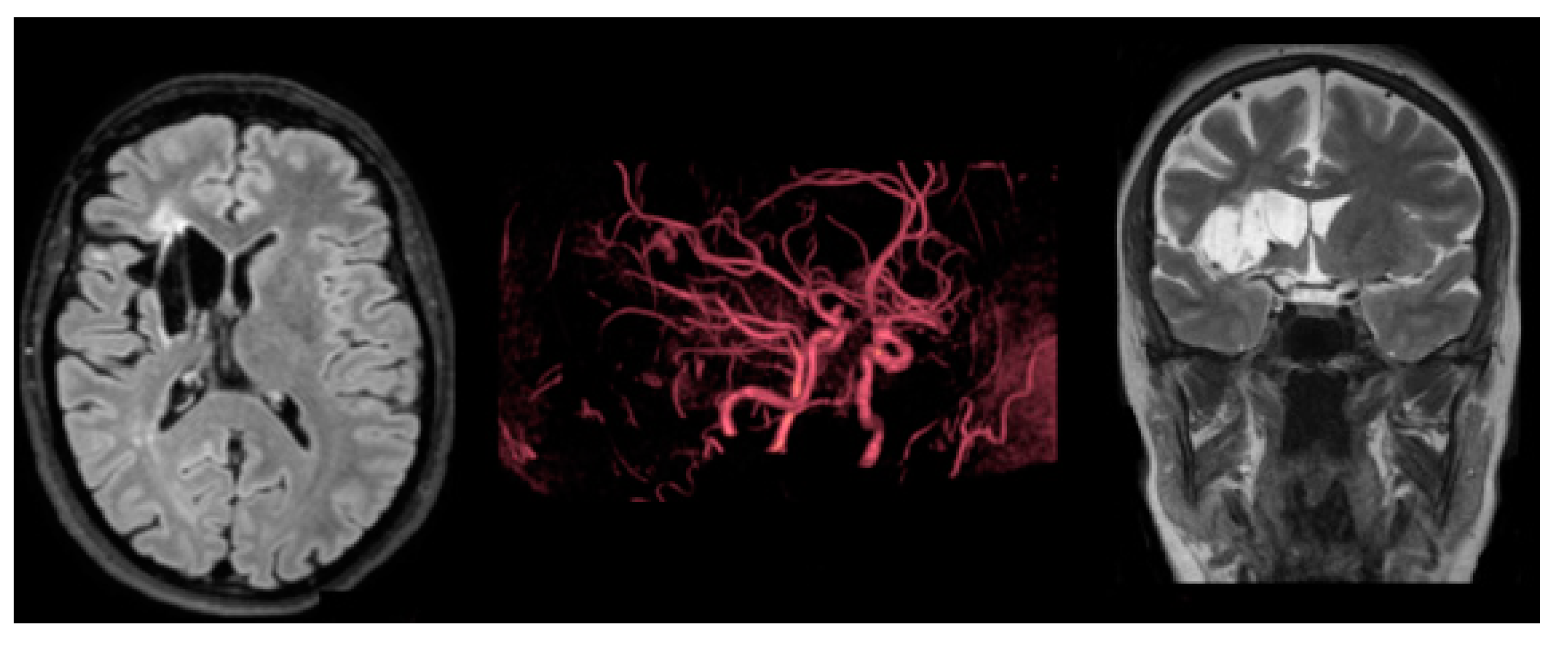 Medsci 11 00034 g003 Medsci 11 00034 g003