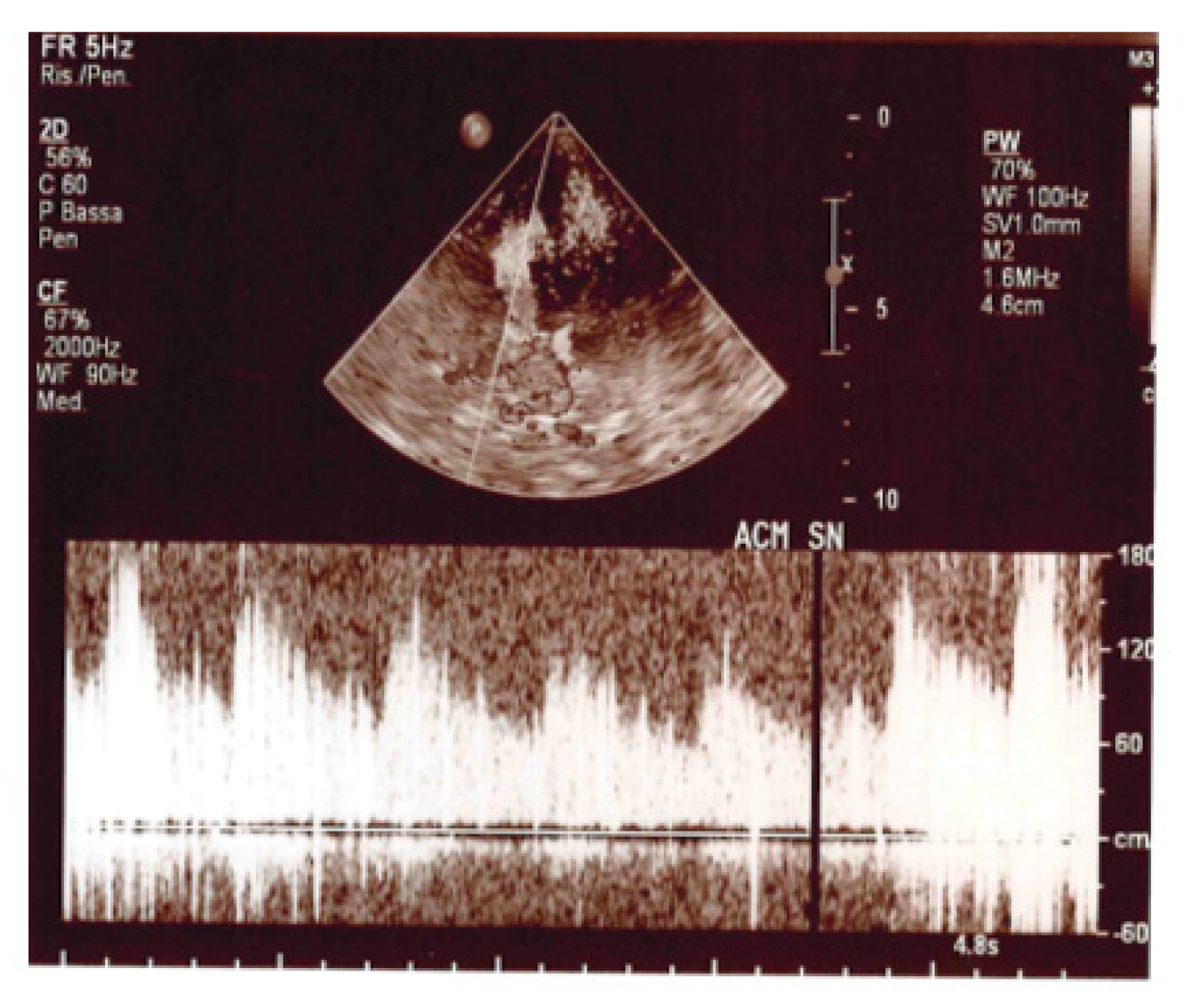 Medsci 11 00034 g005 Medsci 11 00034 g005