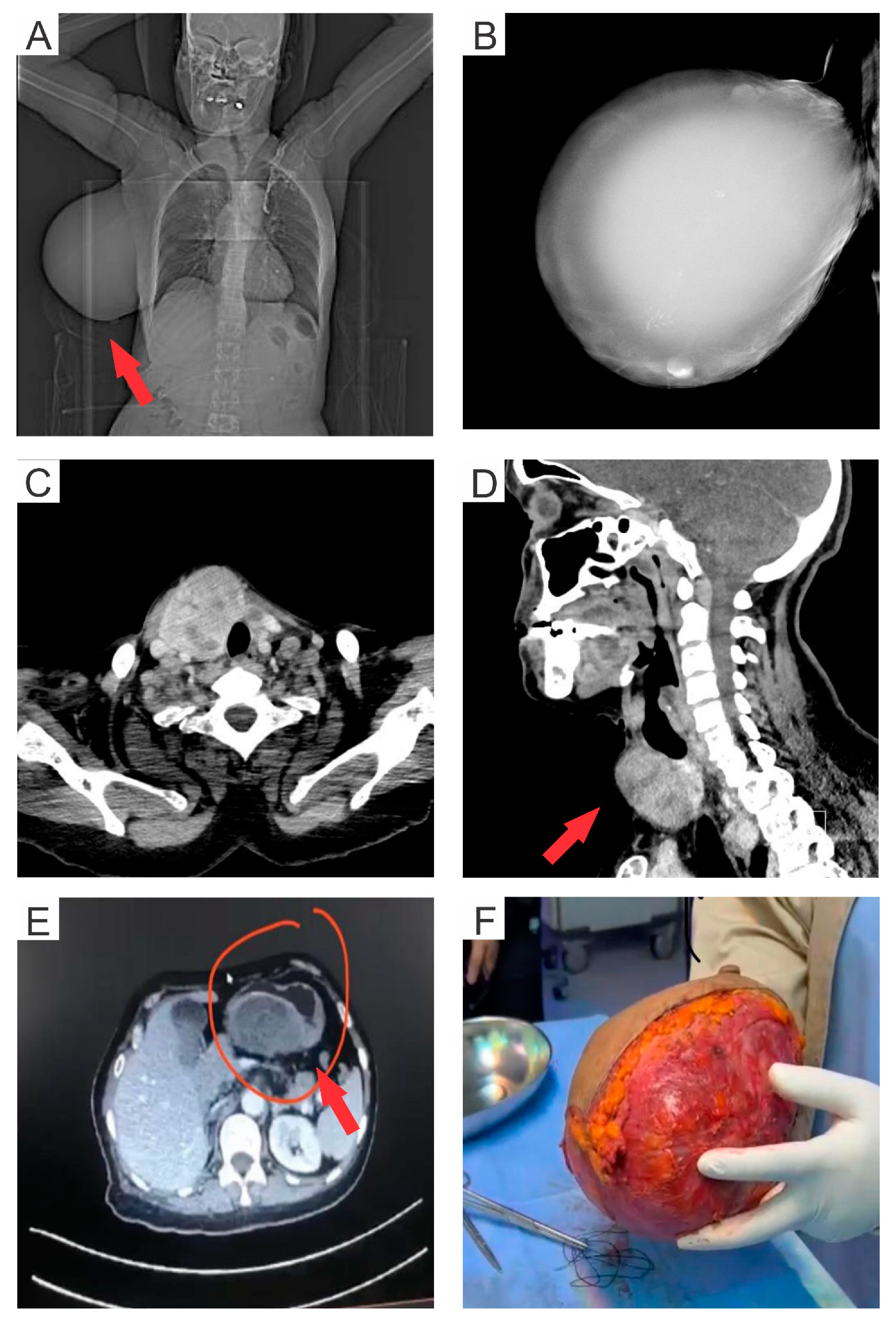 Medsci 11 00057 g001