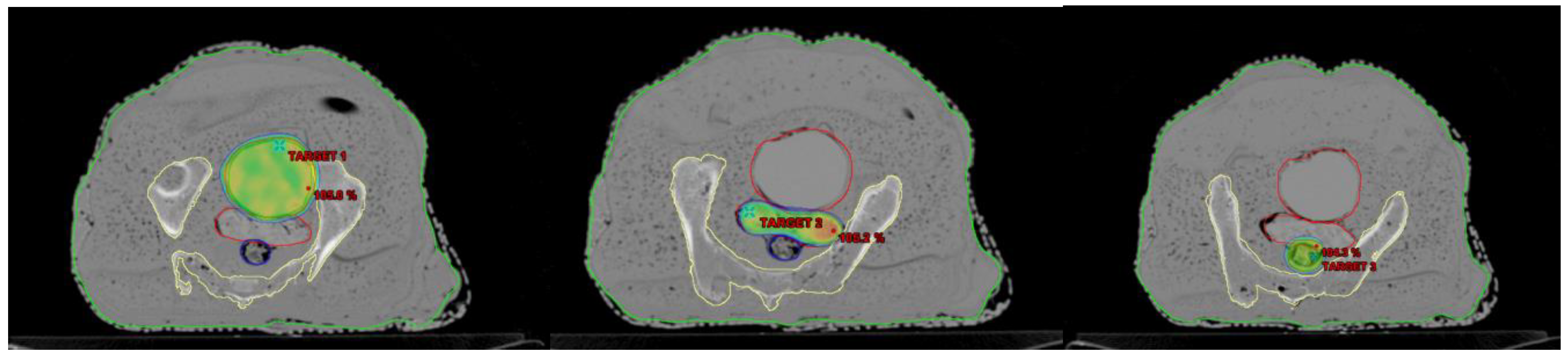 Medsci 11 00059 g004