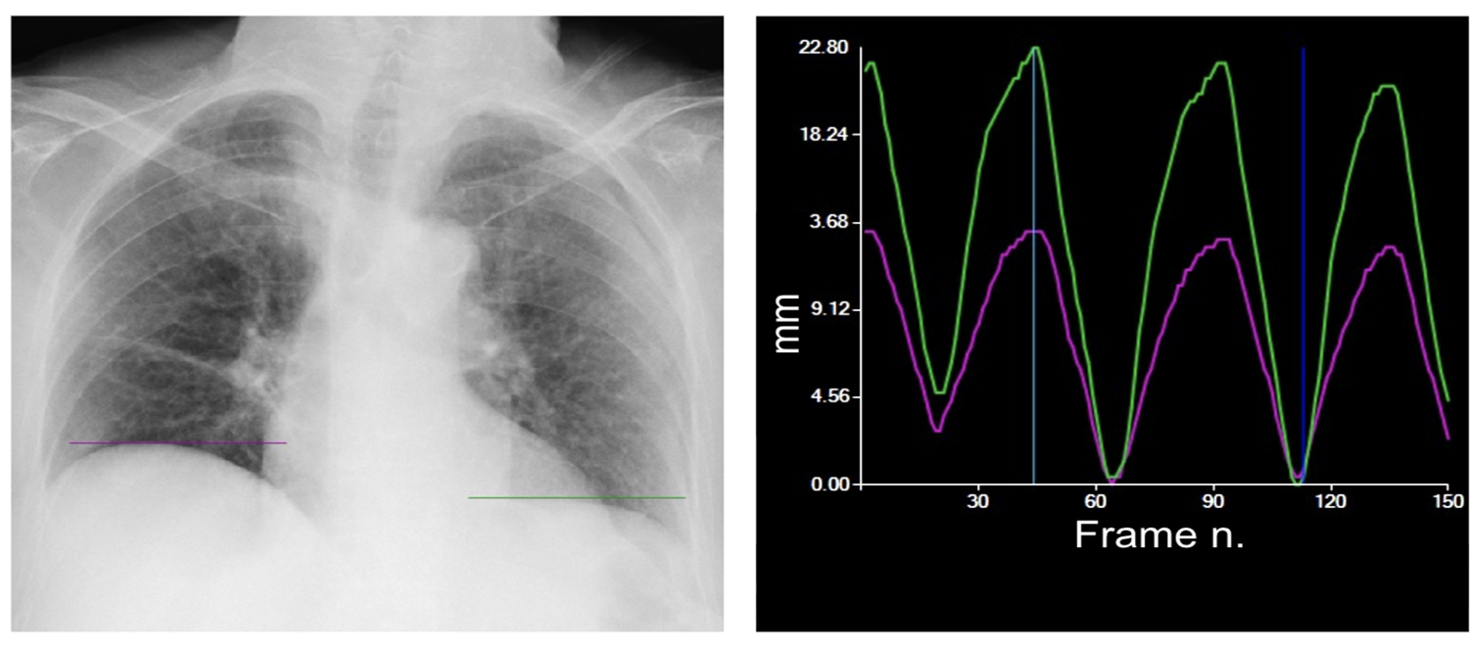 Medsci 12 00010 g004