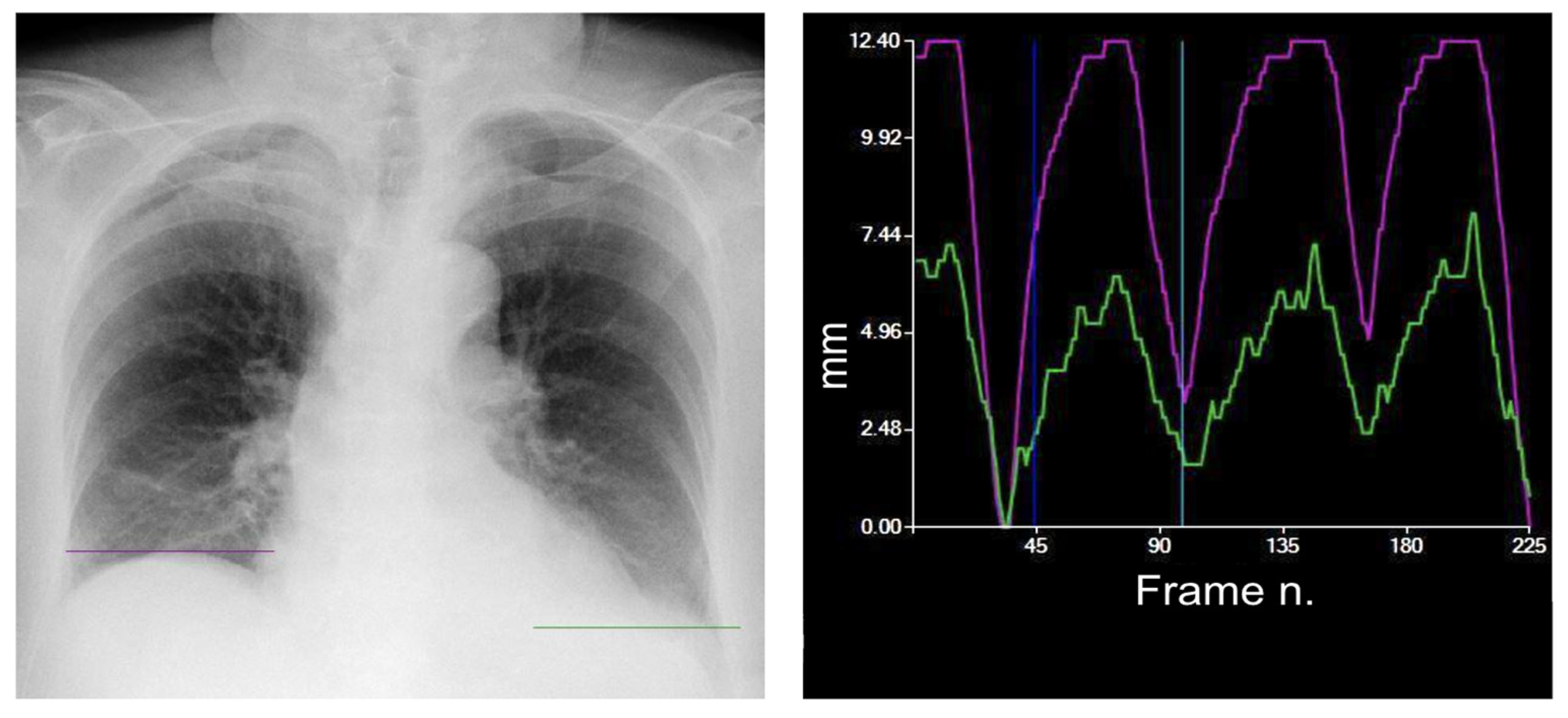 Medsci 12 00010 g005