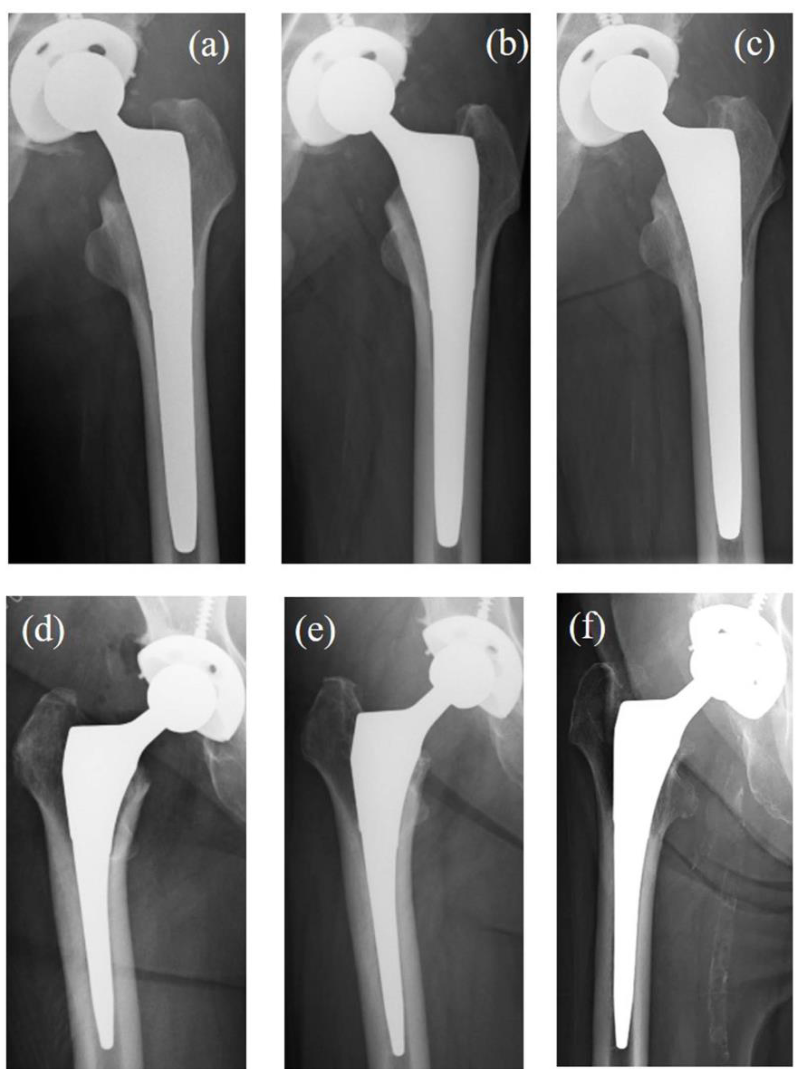 Medsci 13 00051 g004