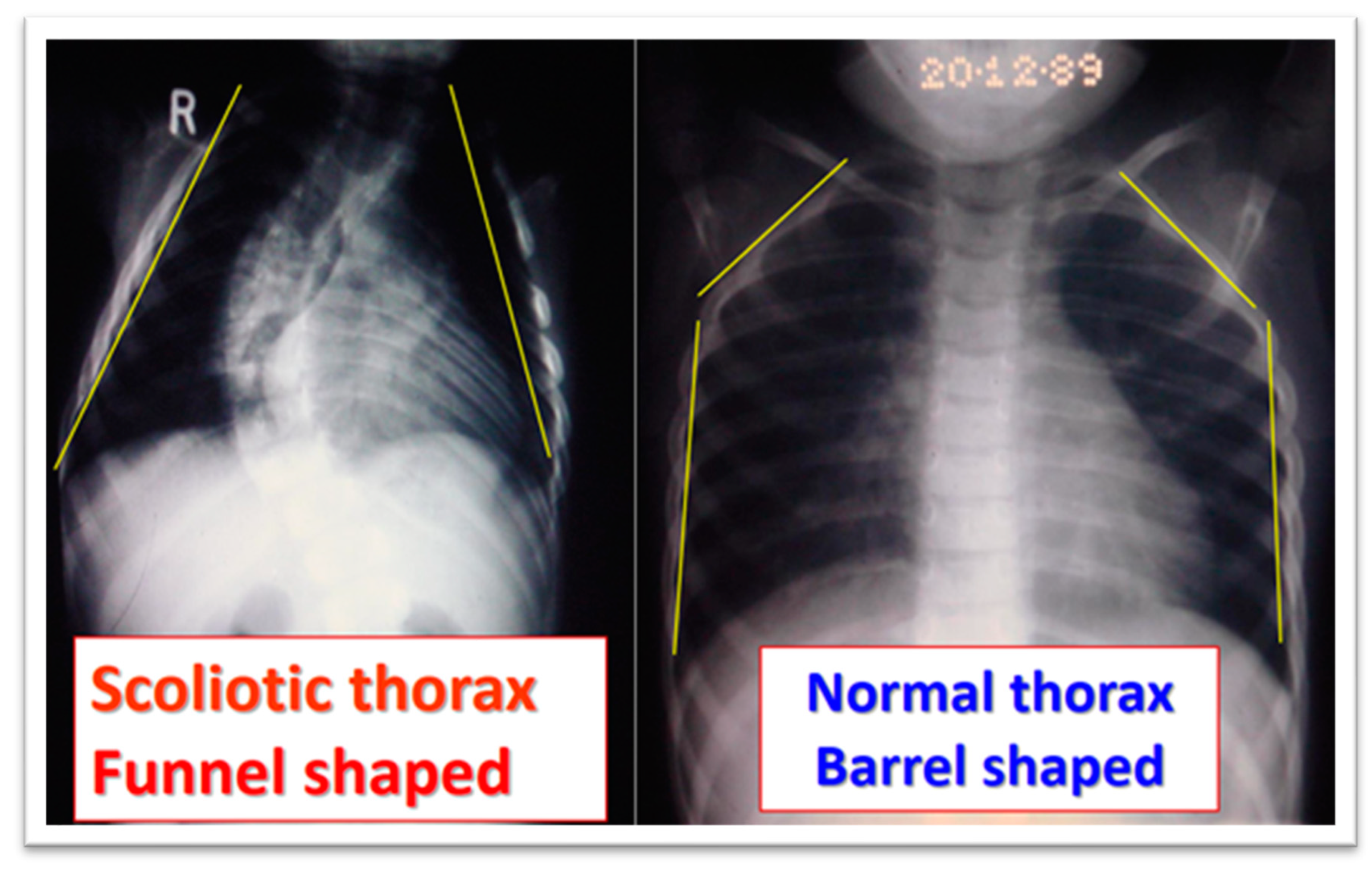 Medsci 13 00062 g006 Medsci 13 00062 g006