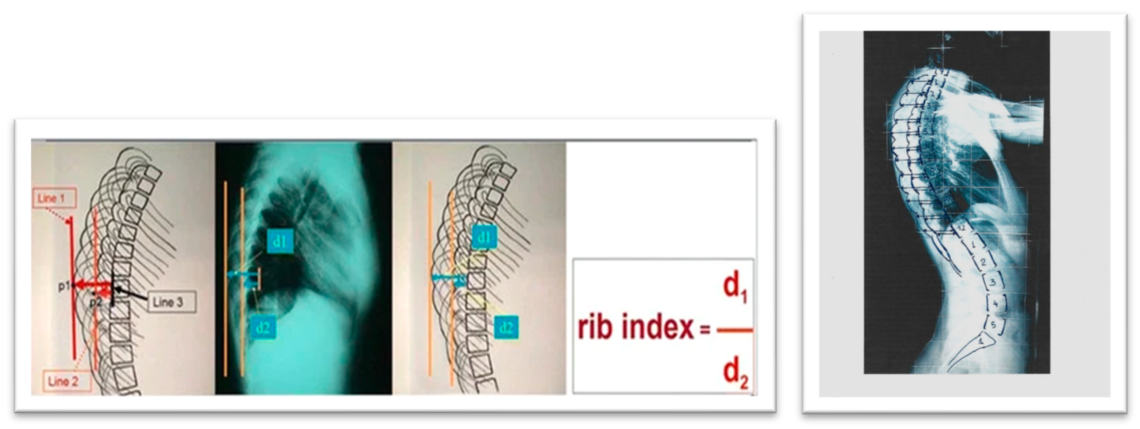 Medsci 13 00062 g014