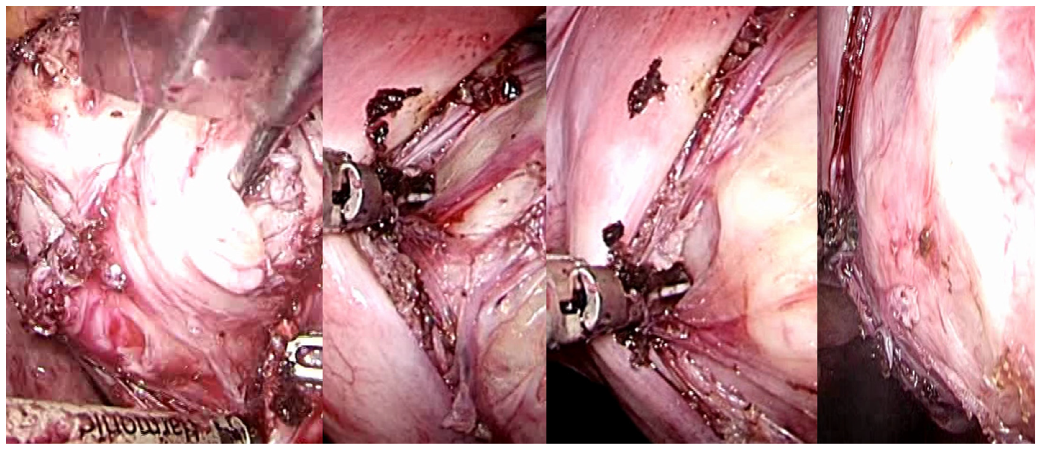 Medsci 13 00068 g006