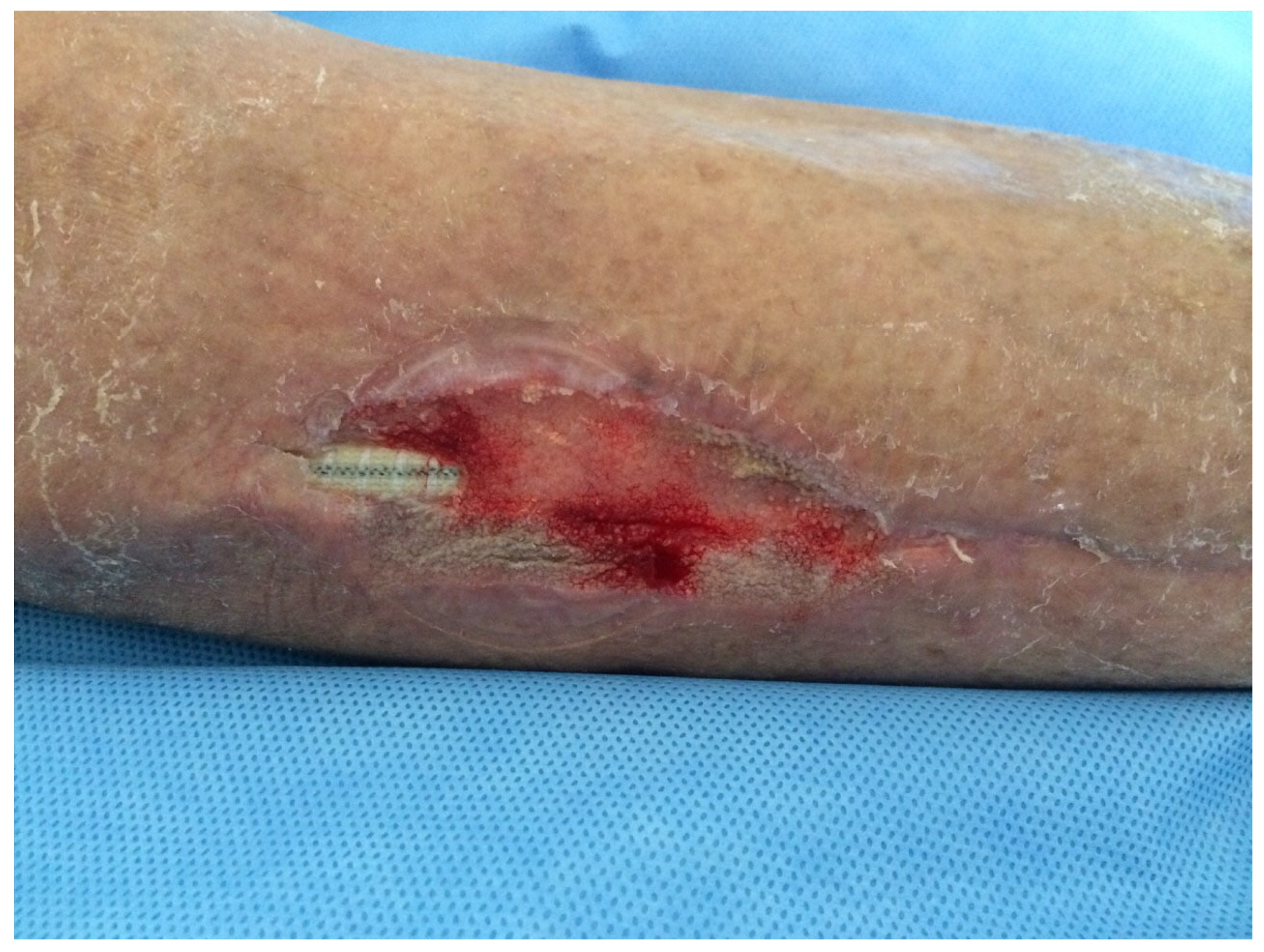 Medsci 13 00071 g003 Medsci 13 00071 g003