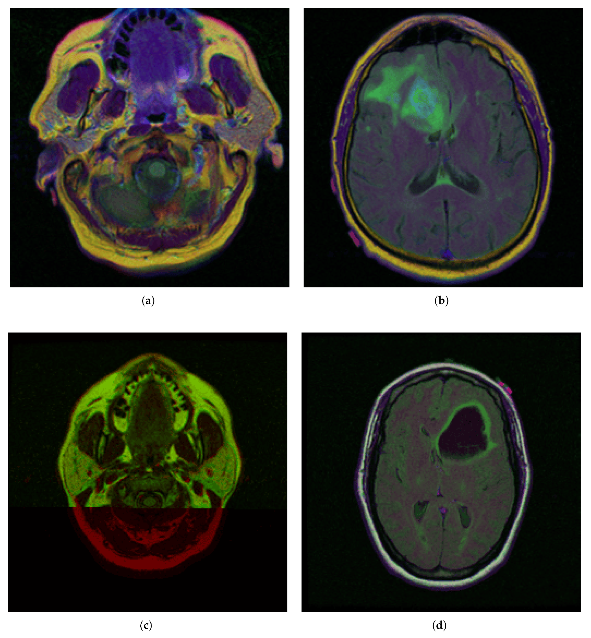 Medsci 13 00097 g002
