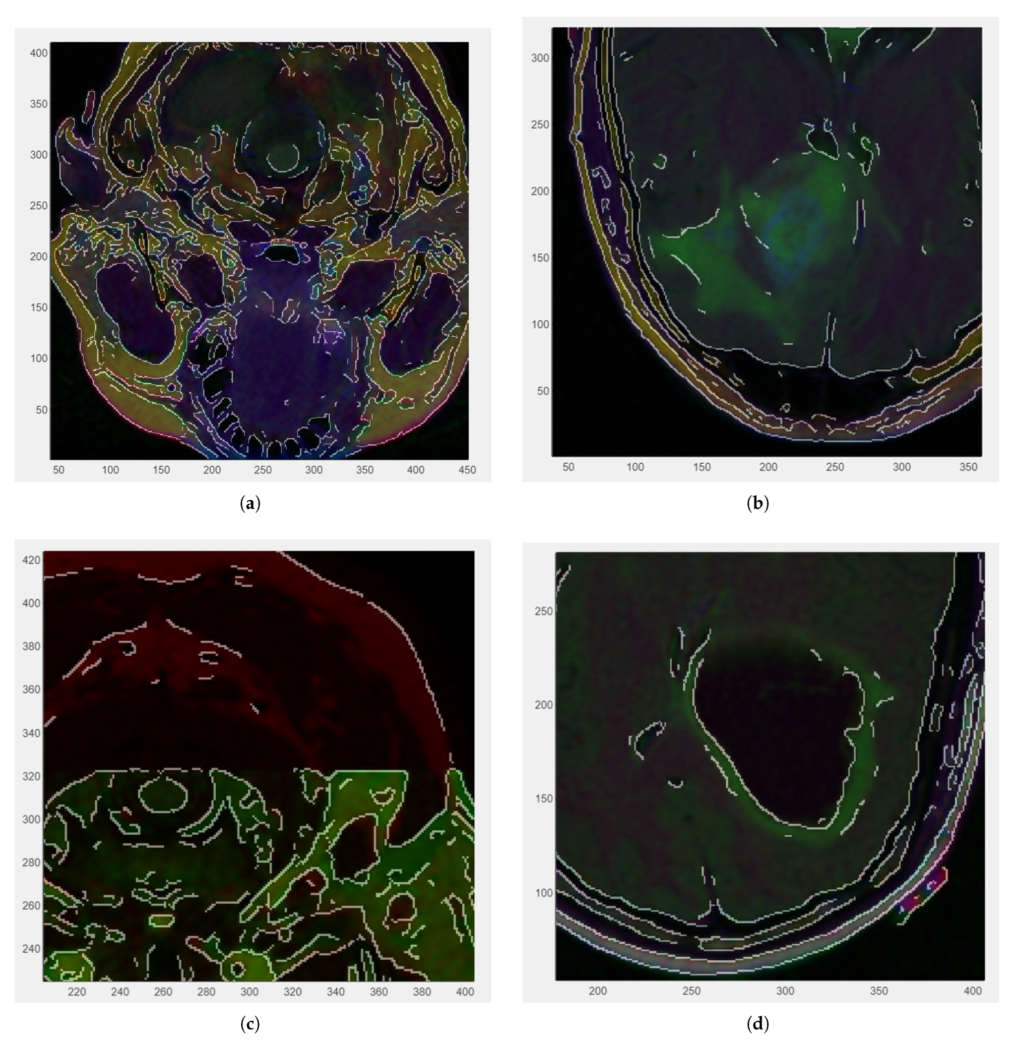 Medsci 13 00097 g003