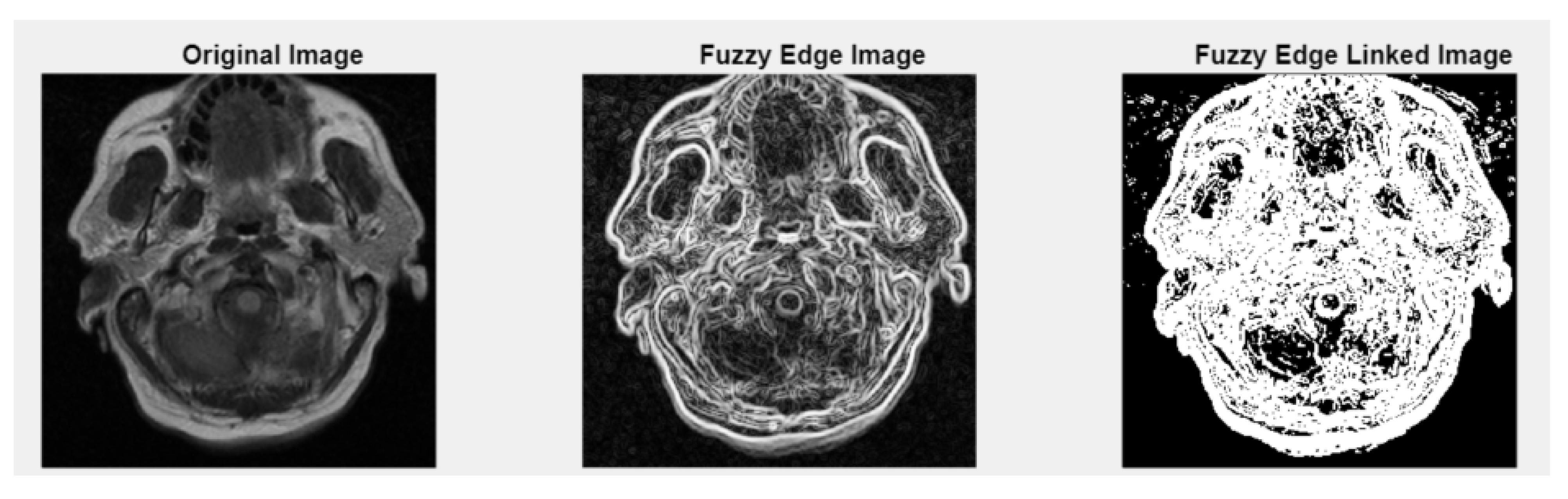 Medsci 13 00097 g005