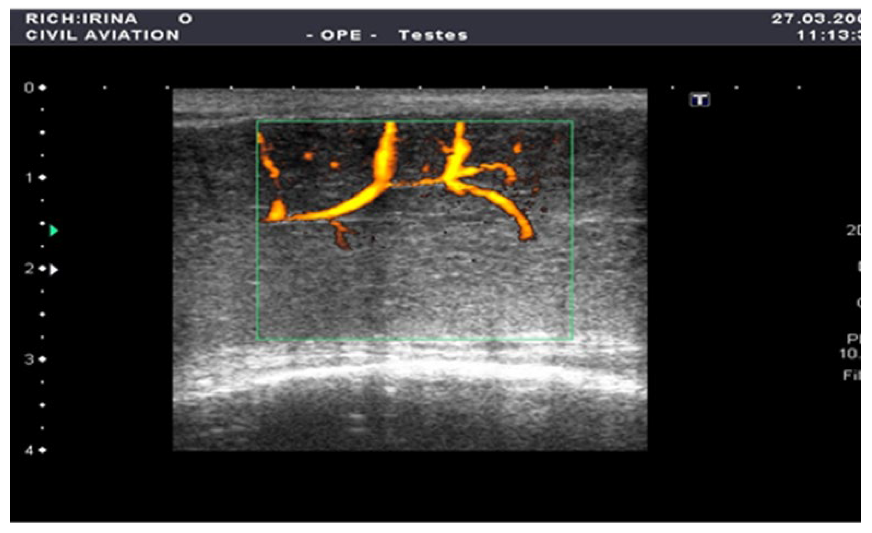 Medsci 13 00208 g002
