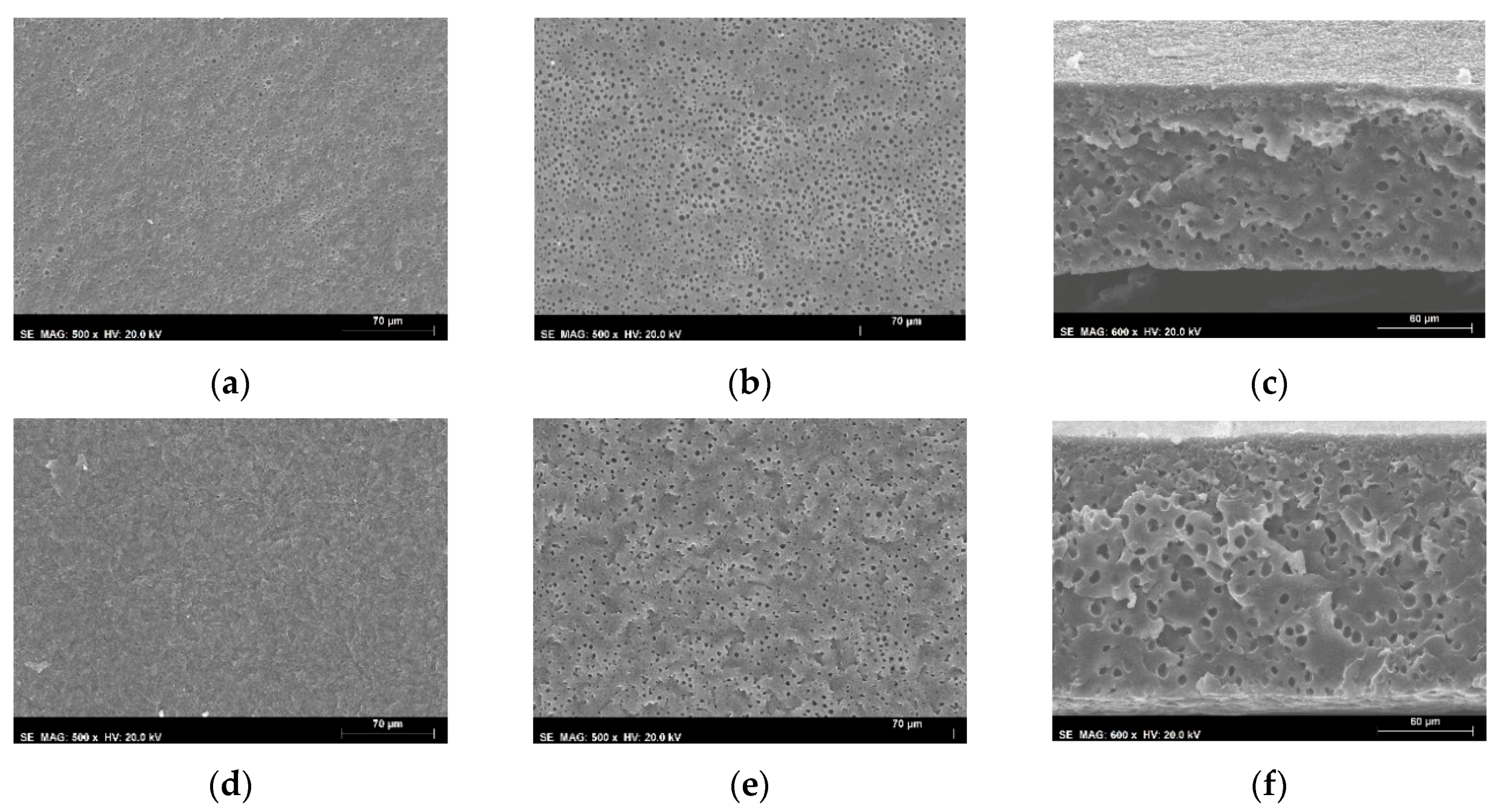 Membranes 10 00008 g0a2