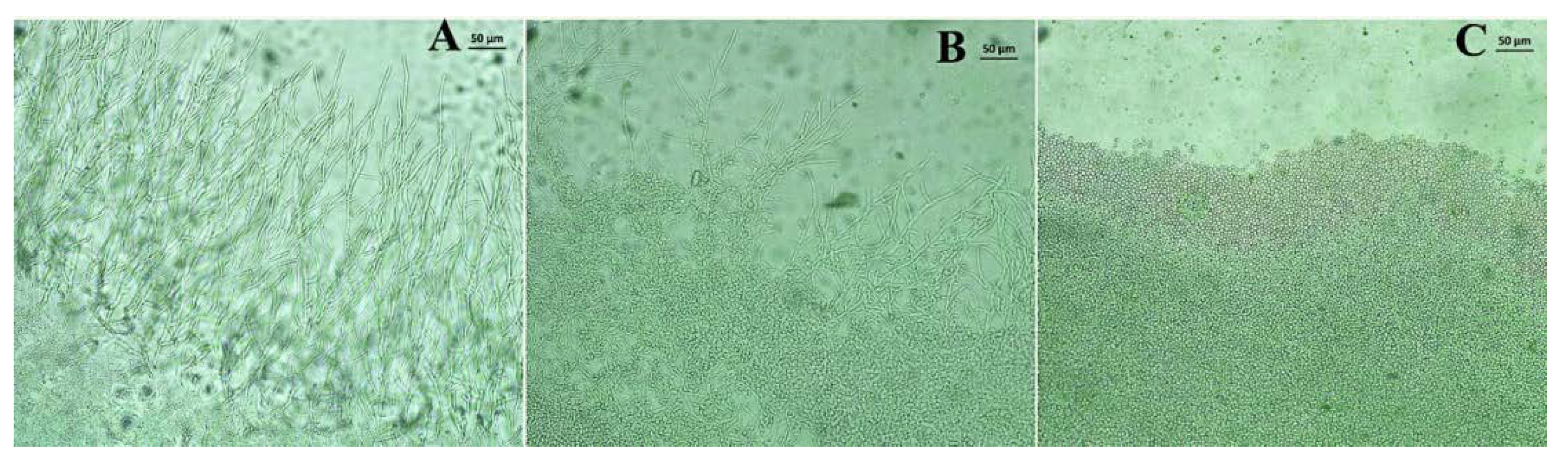 Membranes 10 00194 g004
