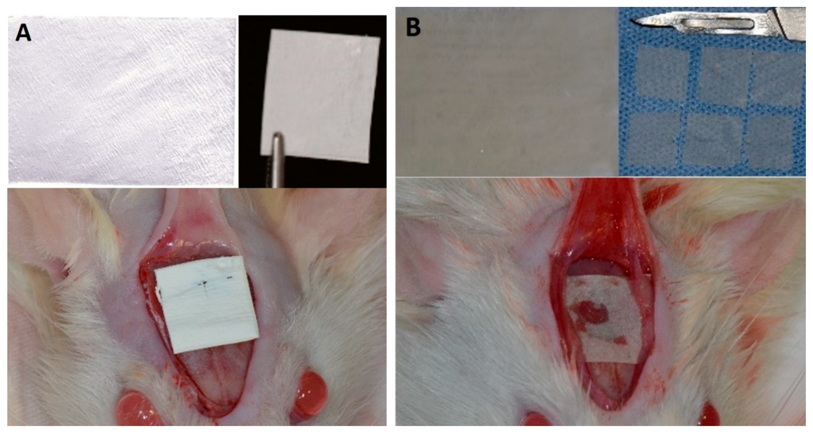 Membranes 10 00230 g001 Membranes 10 00230 g001