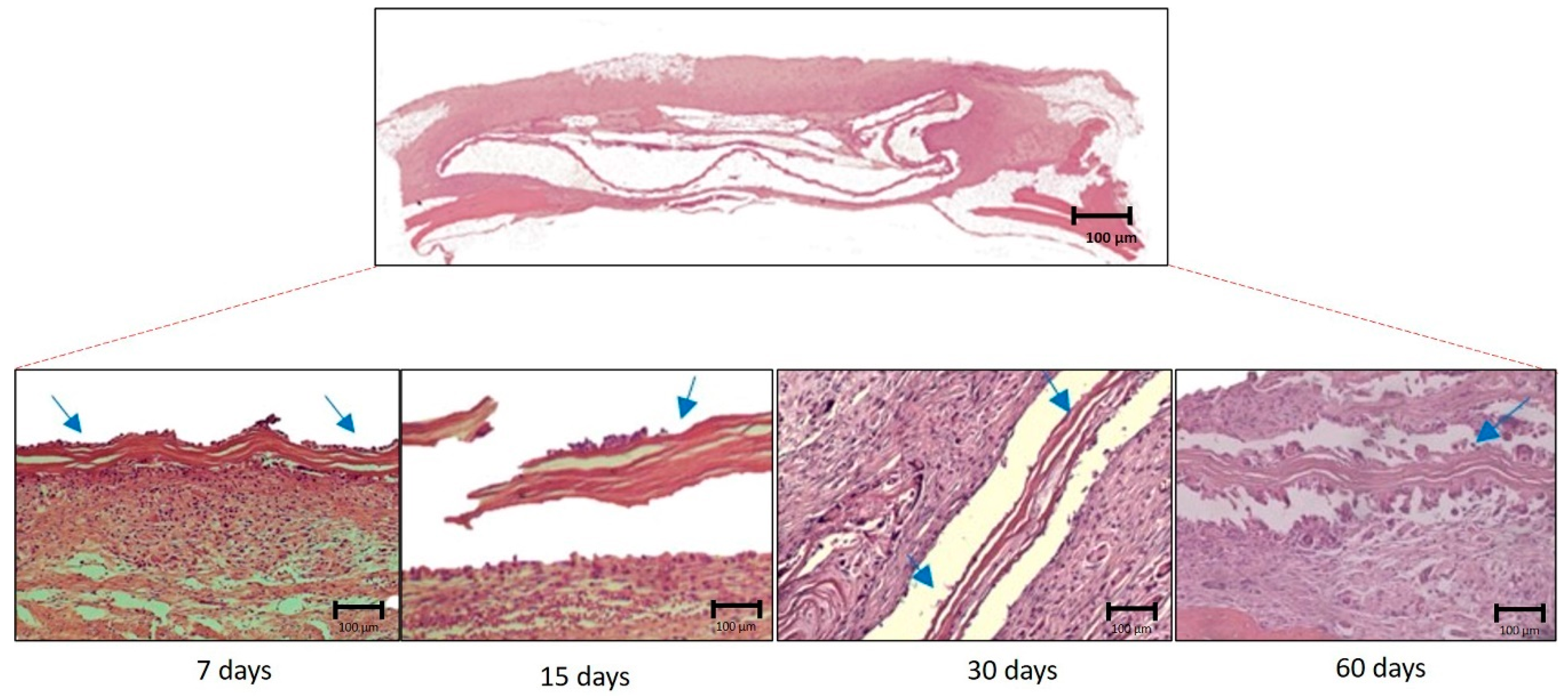 Membranes 10 00230 g006 Membranes 10 00230 g006