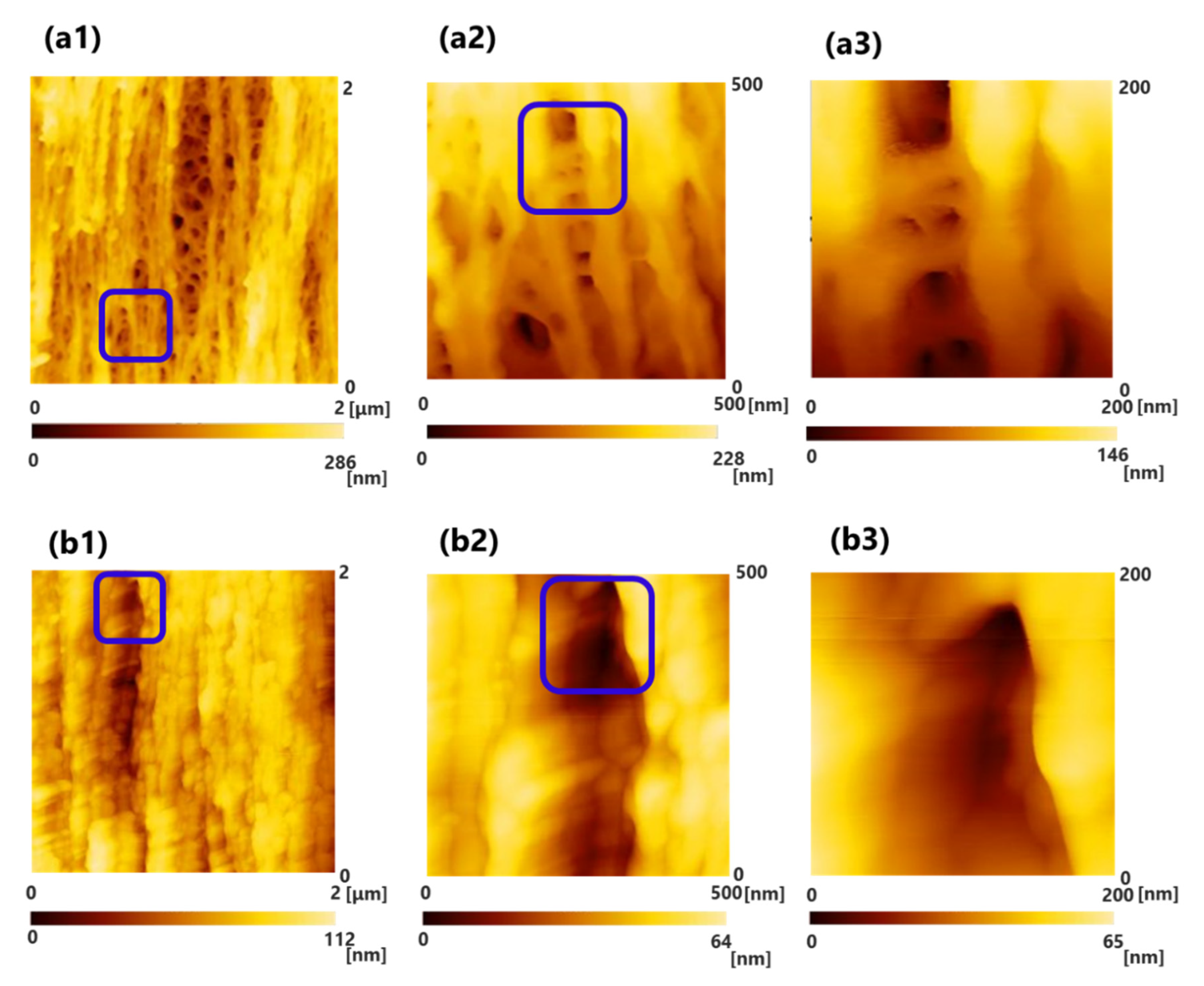 Membranes 10 00315 g002a