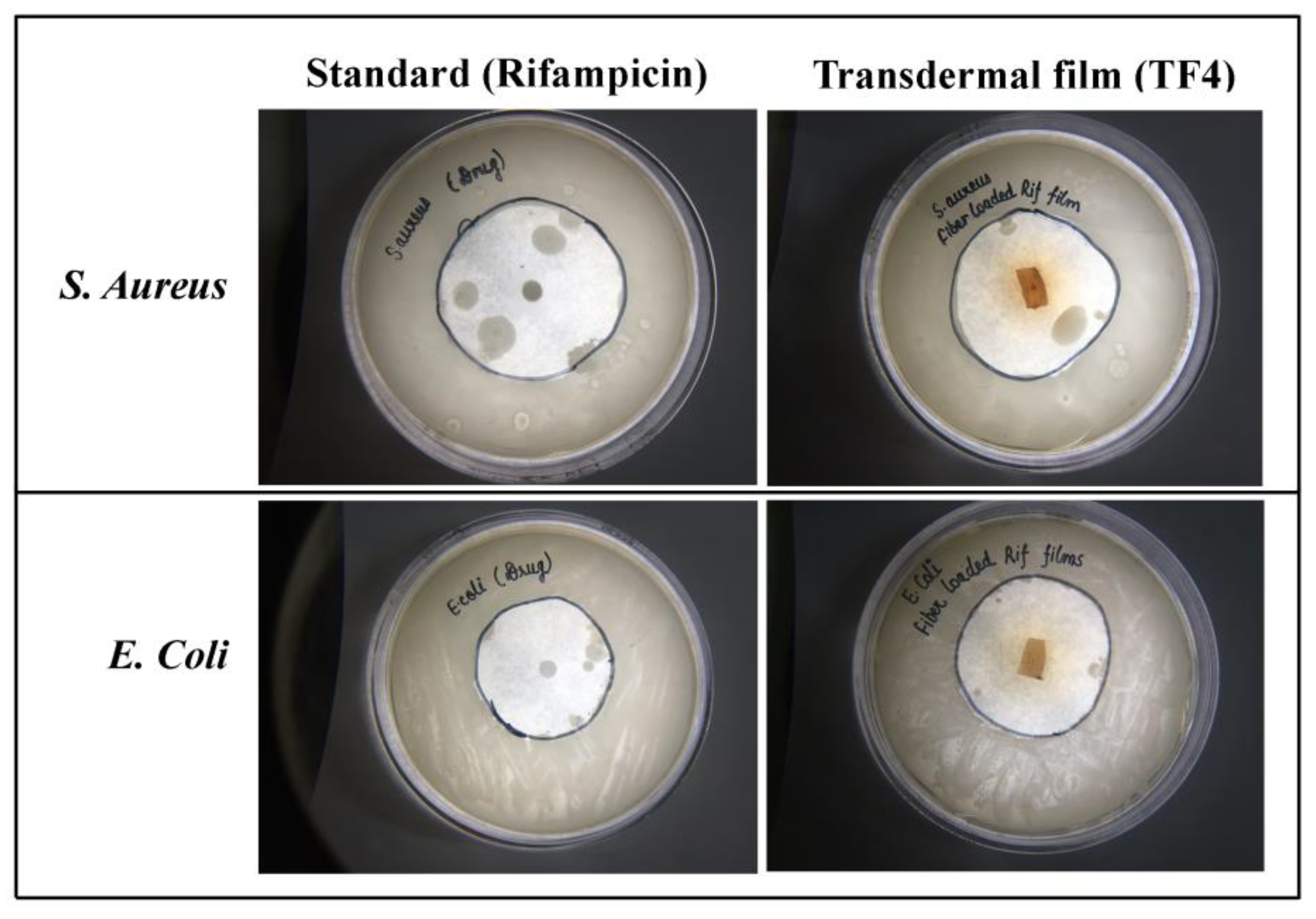 Membranes 11 00007 g007 Membranes 11 00007 g007
