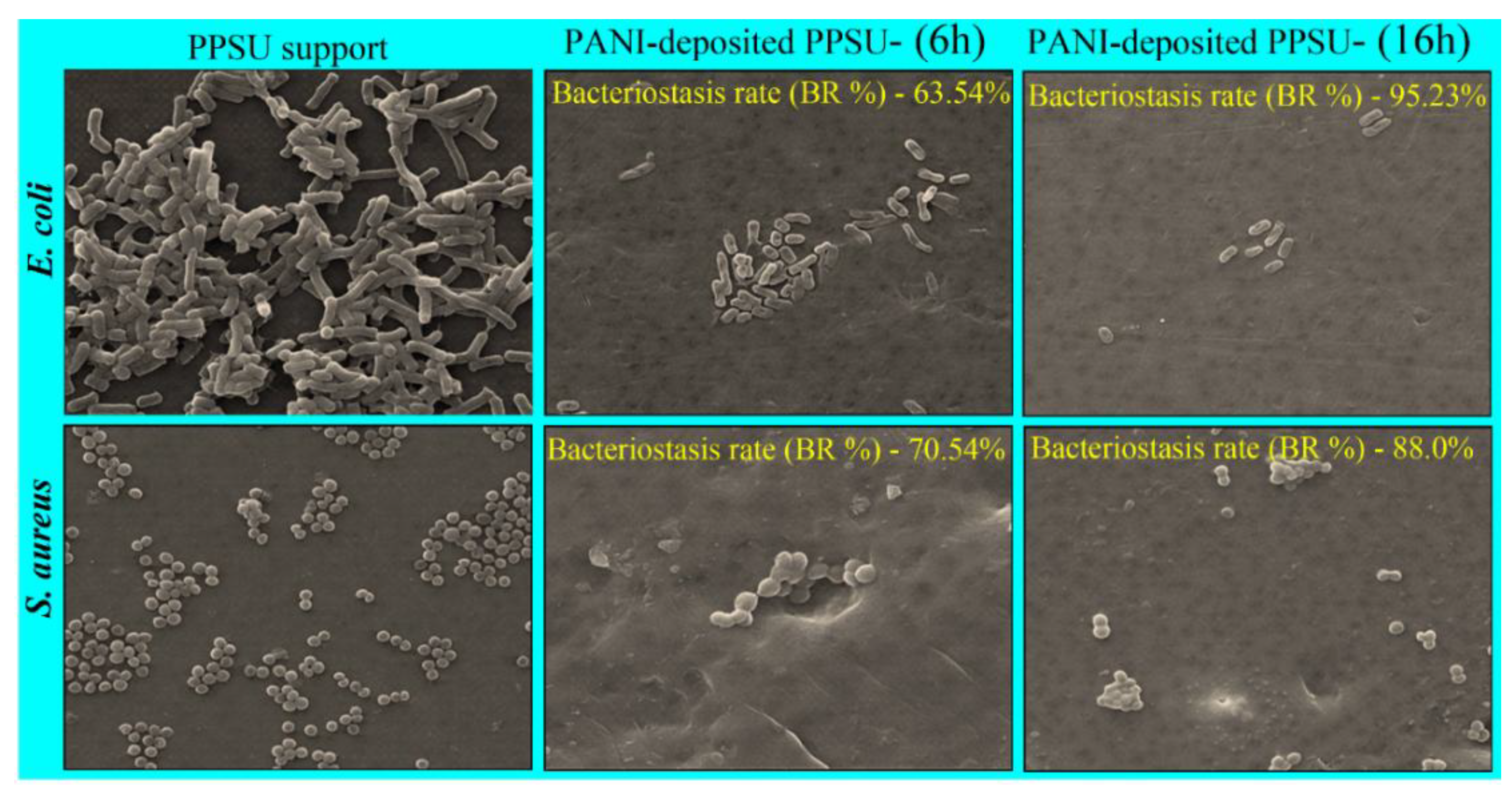 Membranes 11 00025 g011
