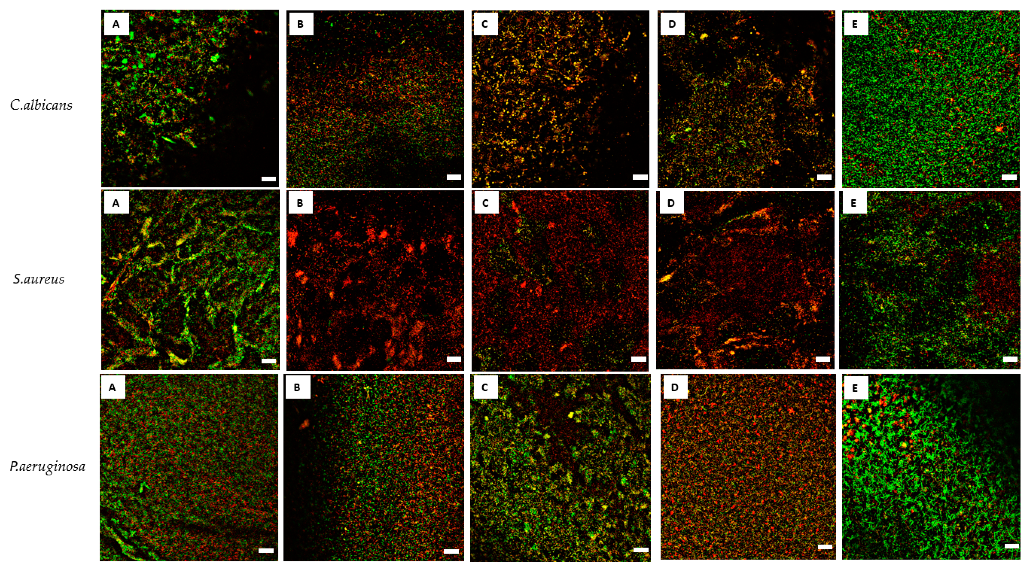 Membranes 11 00062 g004