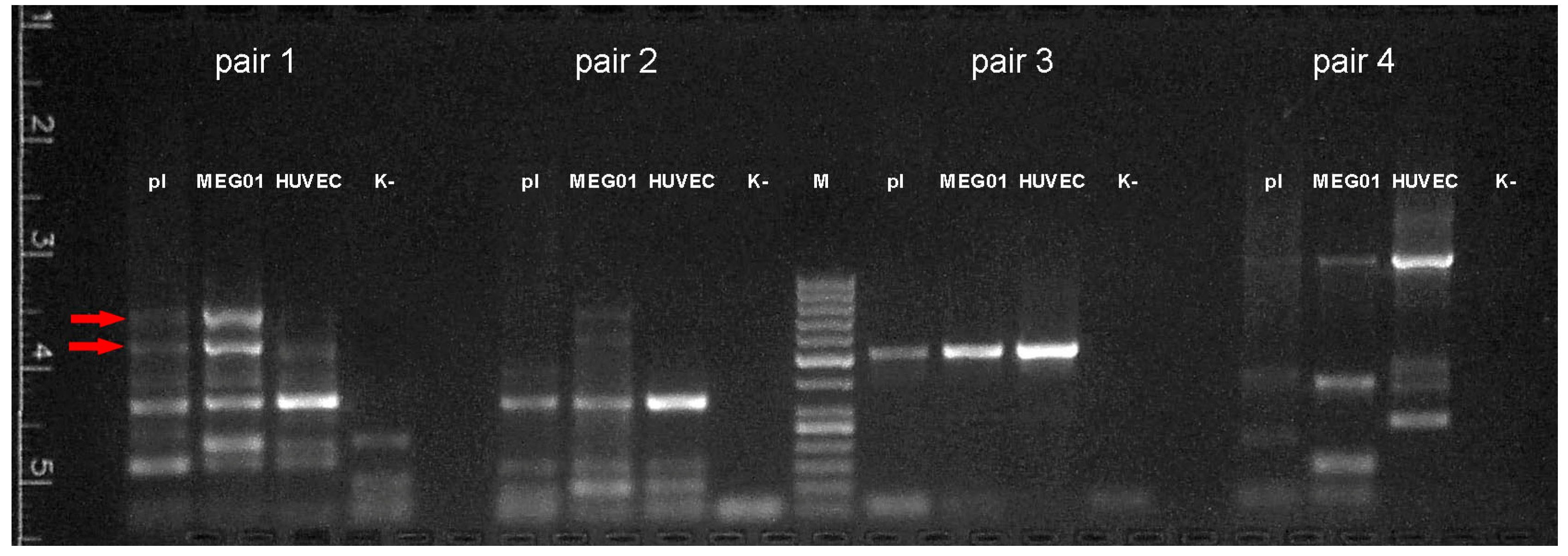 Membranes 11 00218 g006 Membranes 11 00218 g006