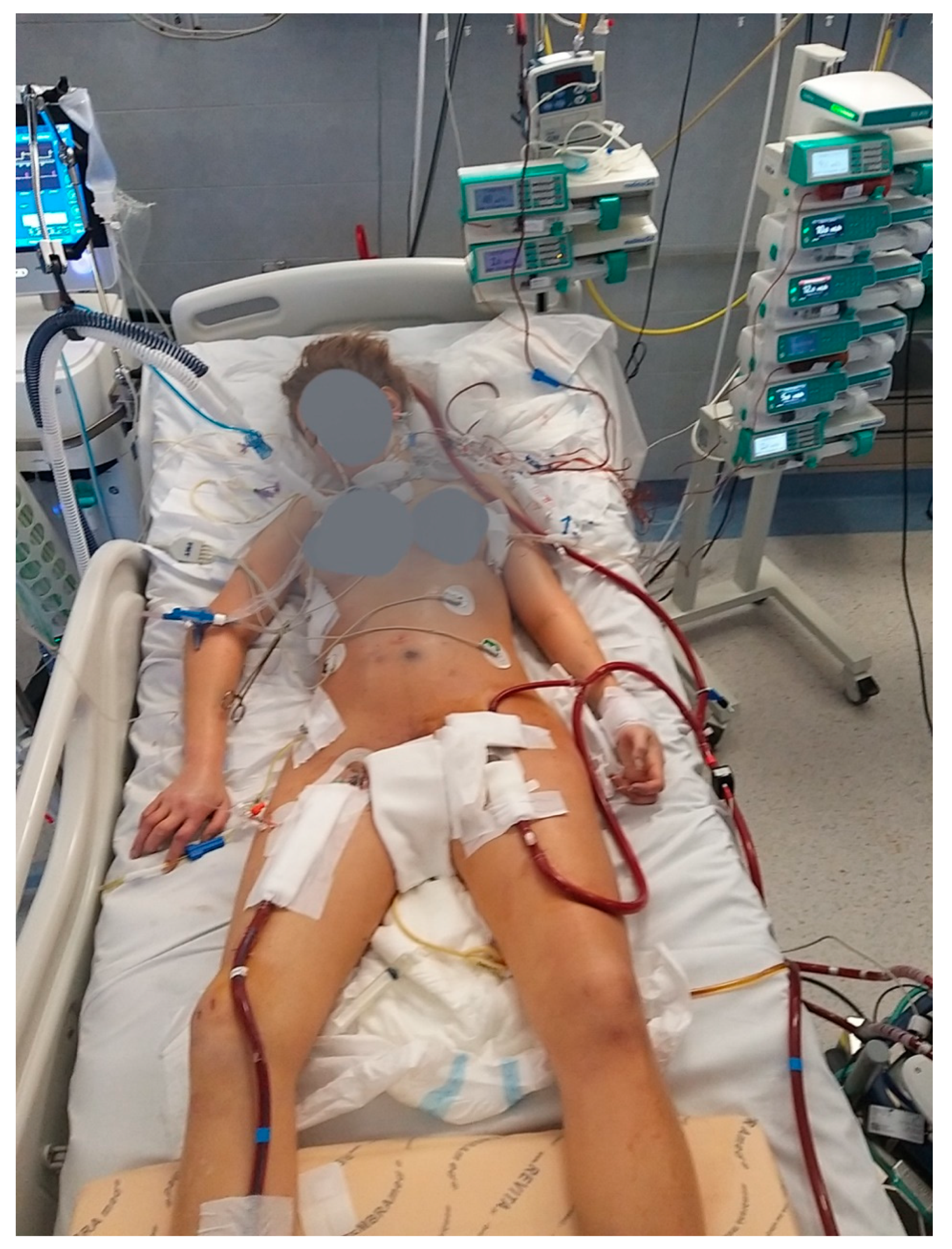 Membranes 11 00434 g003 Membranes 11 00434 g003