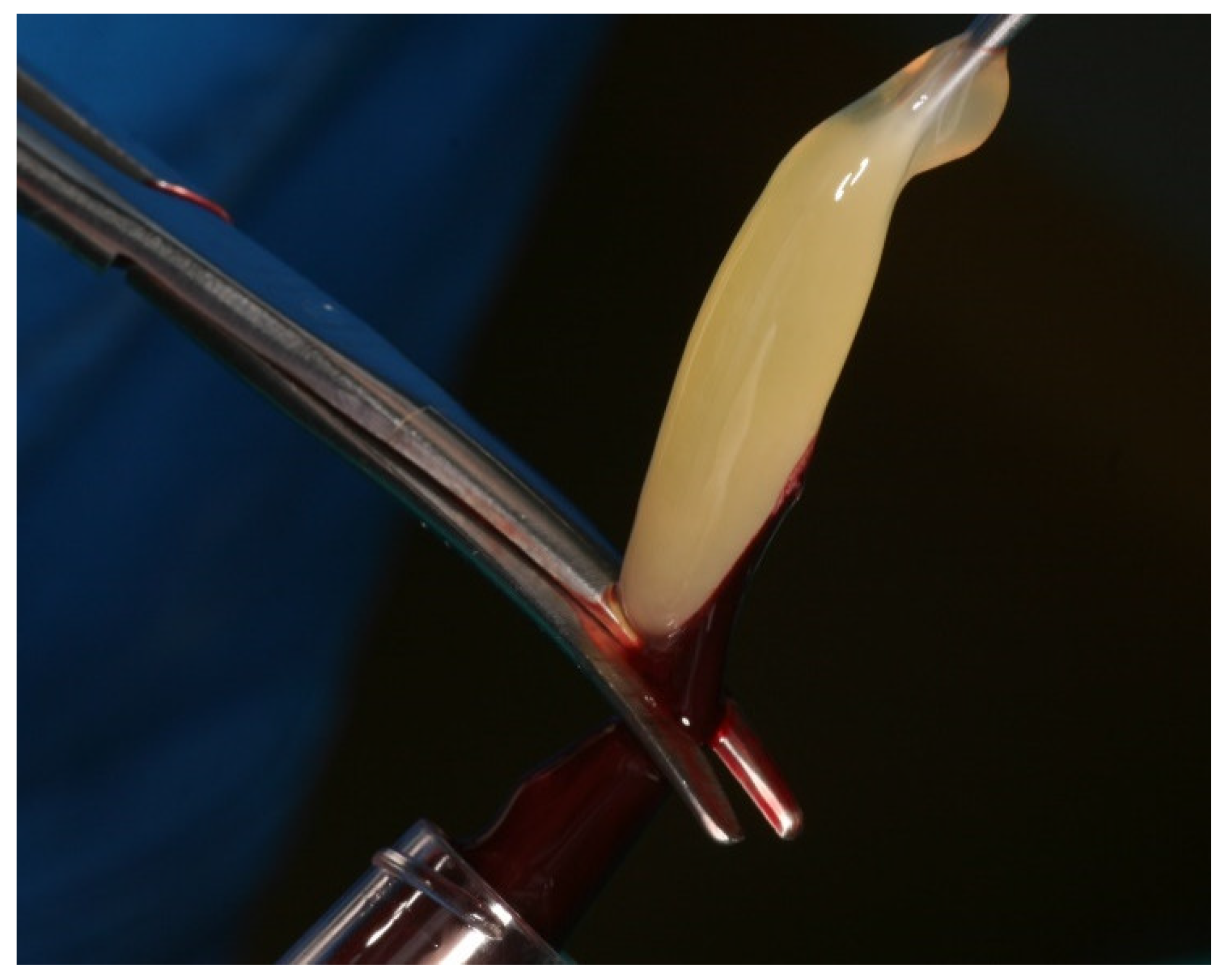 Membranes 11 00438 g002