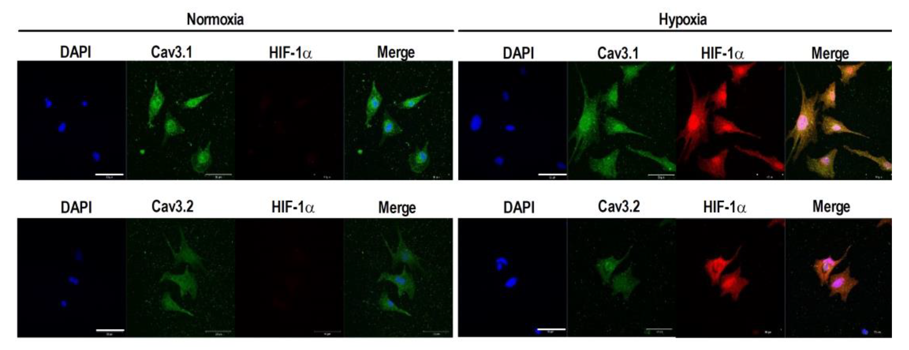 Membranes 11 00470 g003 Membranes 11 00470 g003