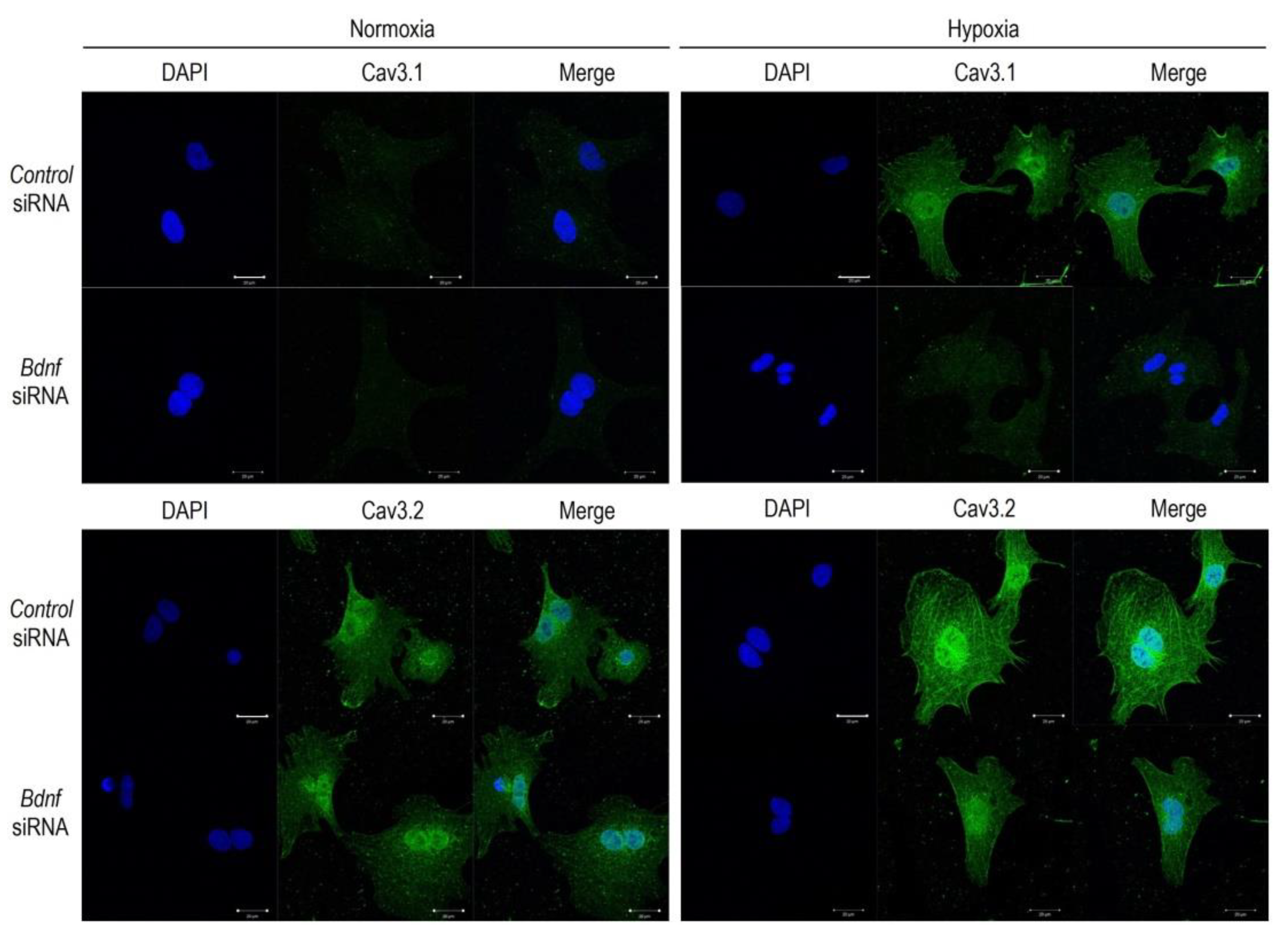 Membranes 11 00470 g006 Membranes 11 00470 g006