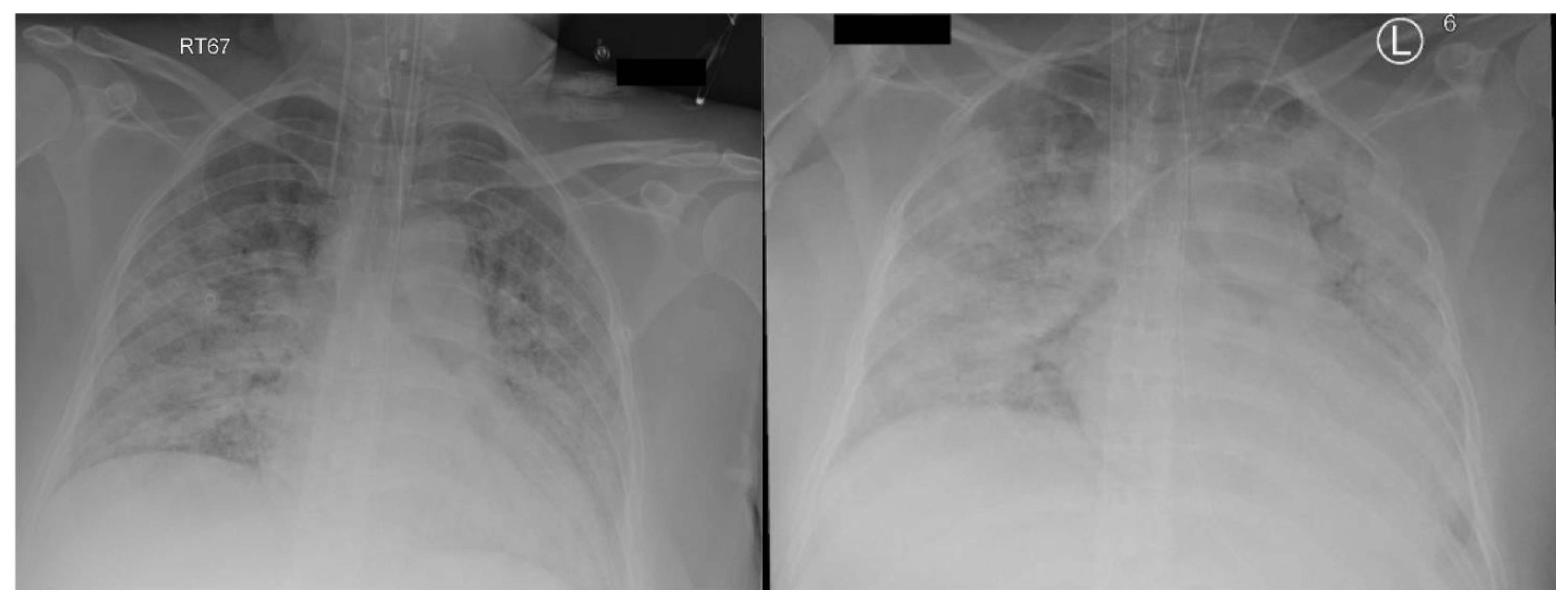 Membranes 11 00544 g001