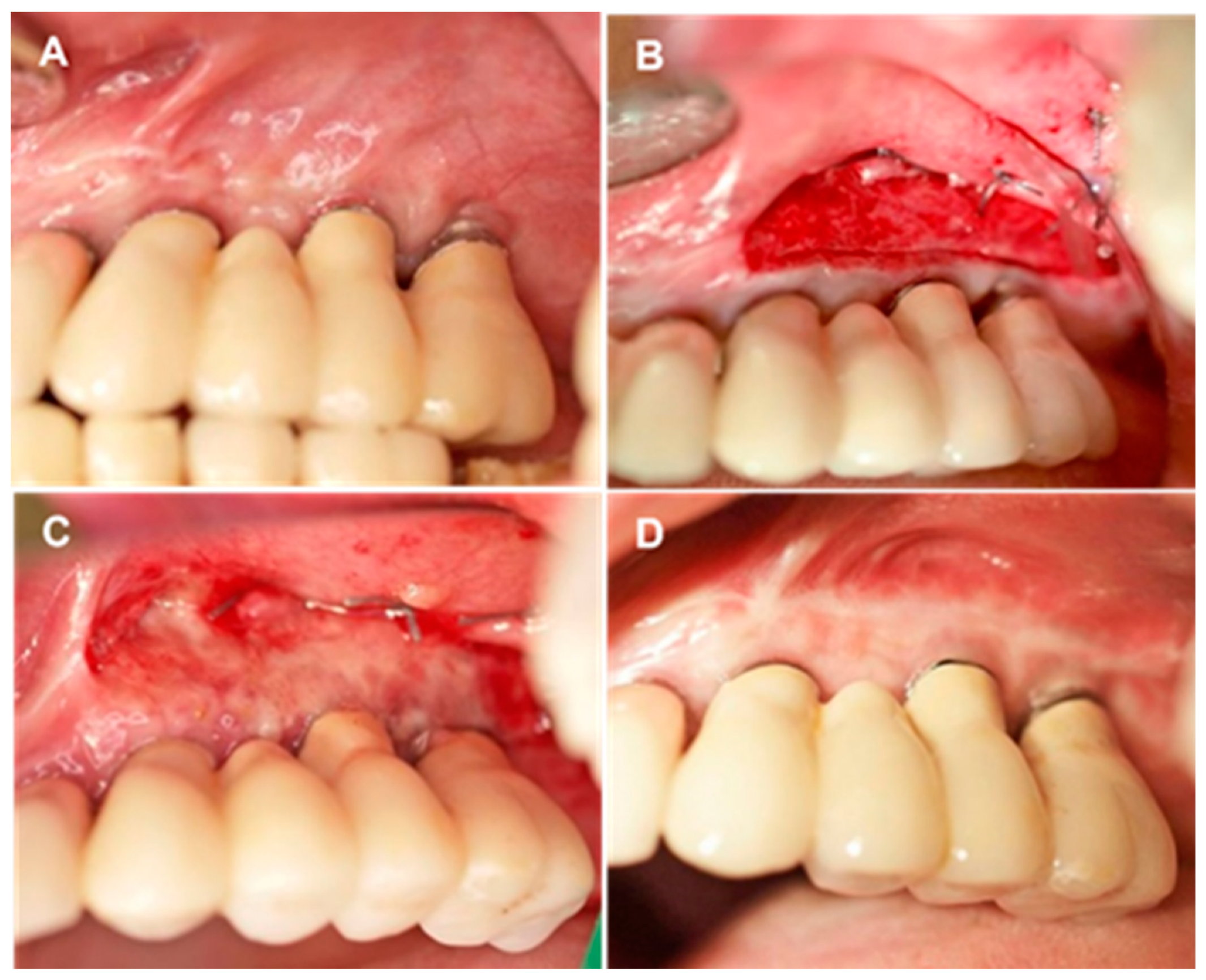 Membranes 11 00698 g001