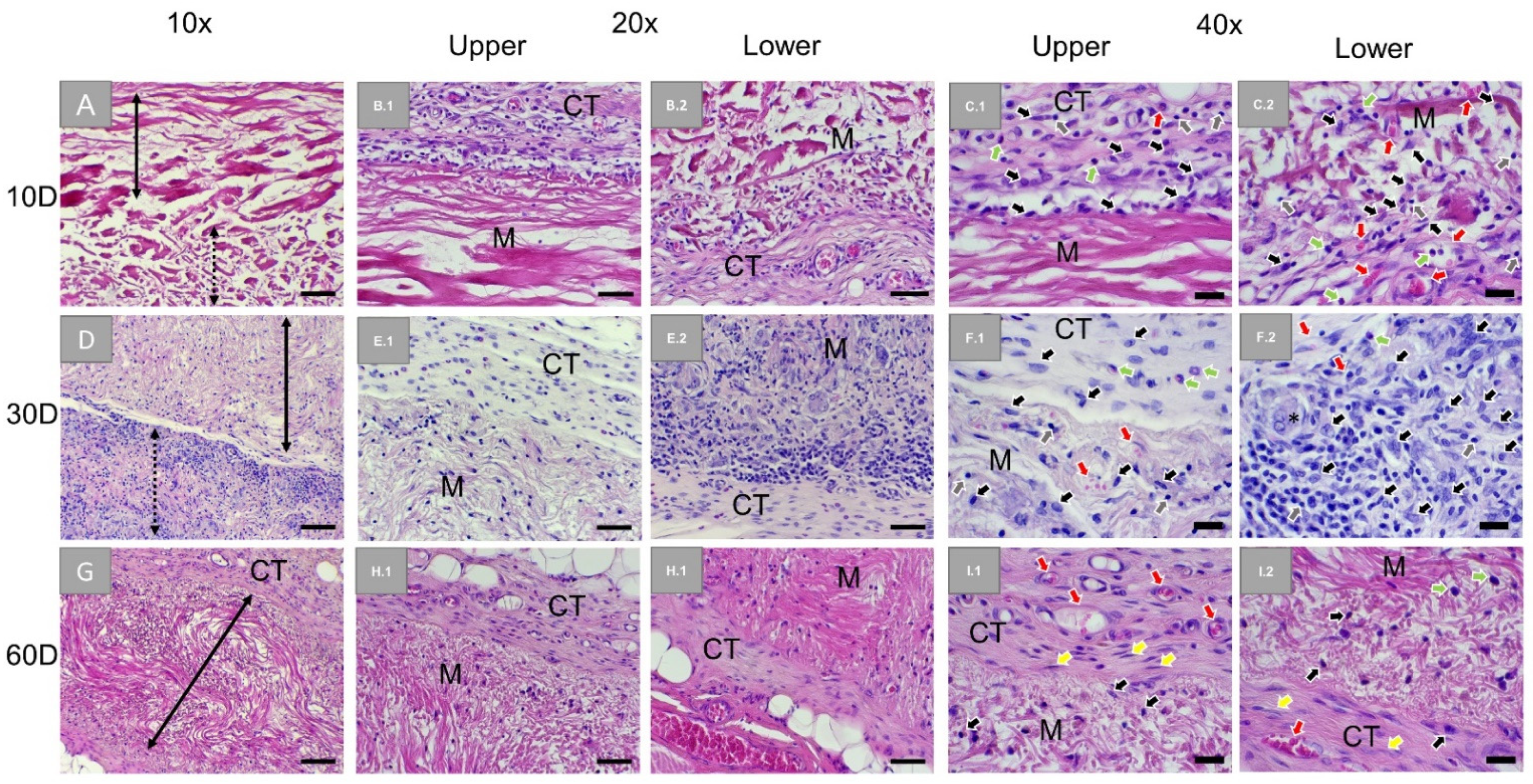 Membranes Free Full Text Comparative In Vivo Analysis Of The Integration Behavior And Immune Response Of Collagen Based Dental Barrier Membranes For Guided Bone Regeneration Gbr Html Membranes Free Full Text Comparative In Vivo Analysis Of The Integration Behavior And Immune Response Of Collagen Based Dental Barrier Membranes For Guided Bone Regeneration Gbr Html
