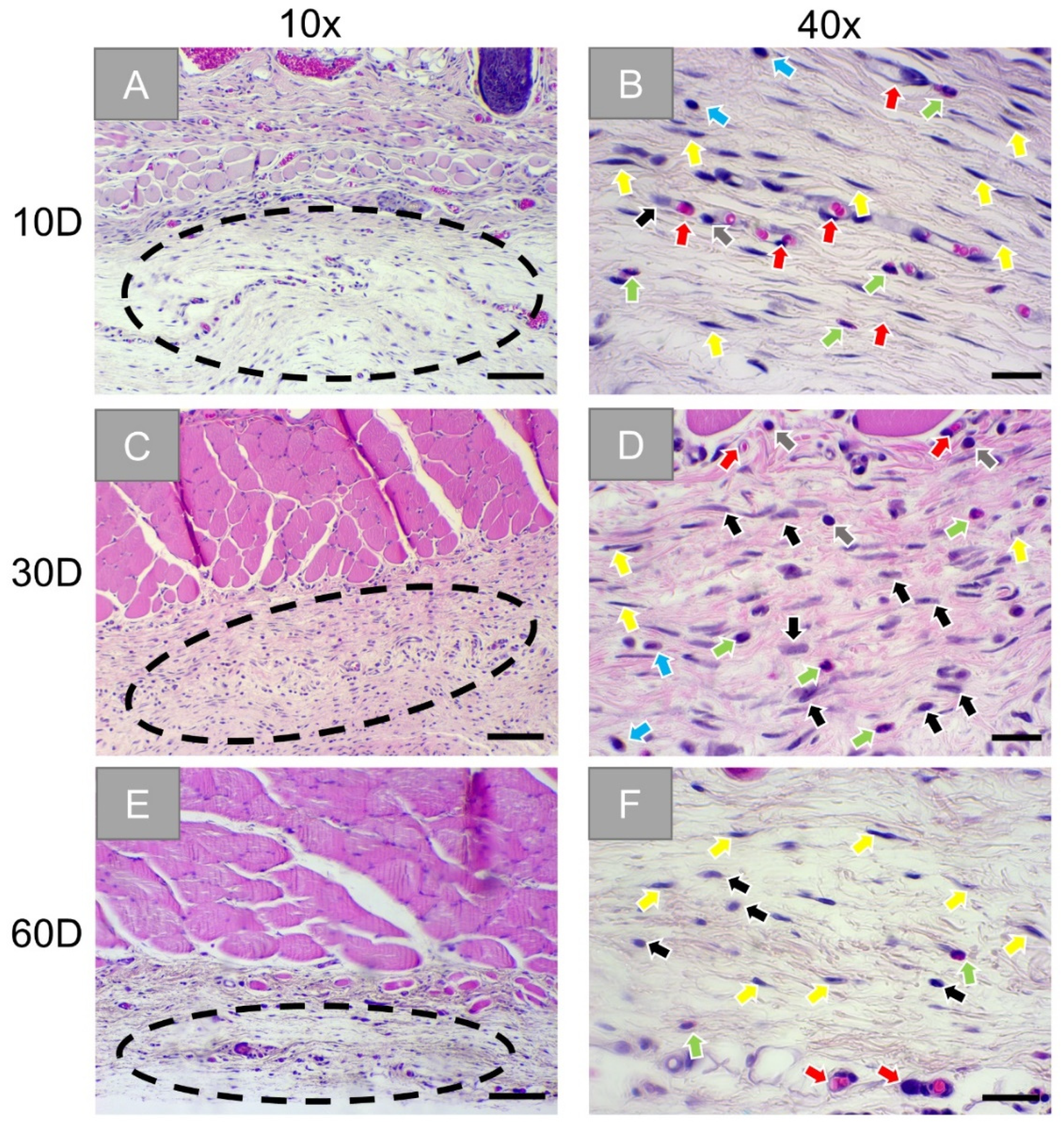Membranes Free Full Text Comparative In Vivo Analysis Of The Integration Behavior And Immune Response Of Collagen Based Dental Barrier Membranes For Guided Bone Regeneration Gbr Html Membranes Free Full Text Comparative In Vivo Analysis Of The Integration Behavior And Immune Response Of Collagen Based Dental Barrier Membranes For Guided Bone Regeneration Gbr Html