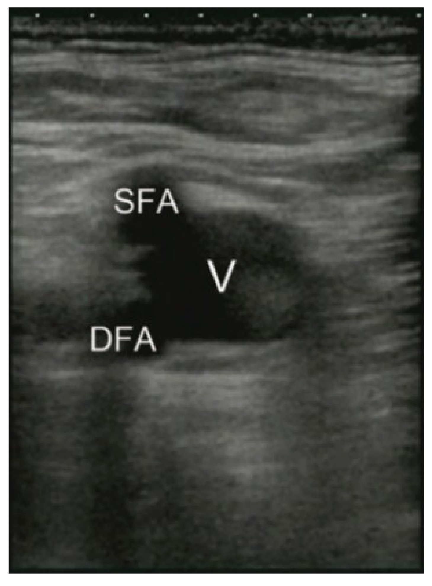 Membranes 11 00744 g002 Membranes 11 00744 g002