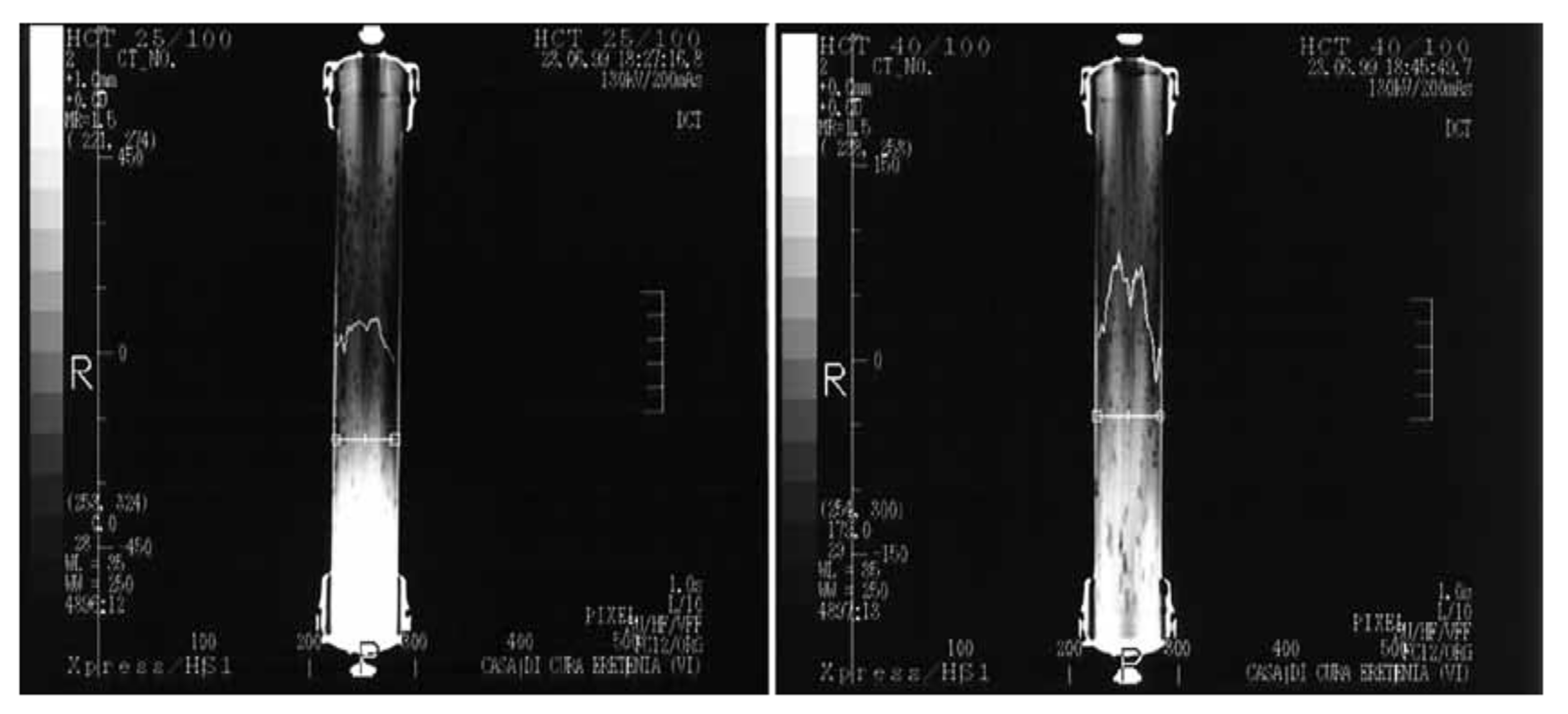 Membranes 11 00767 g011