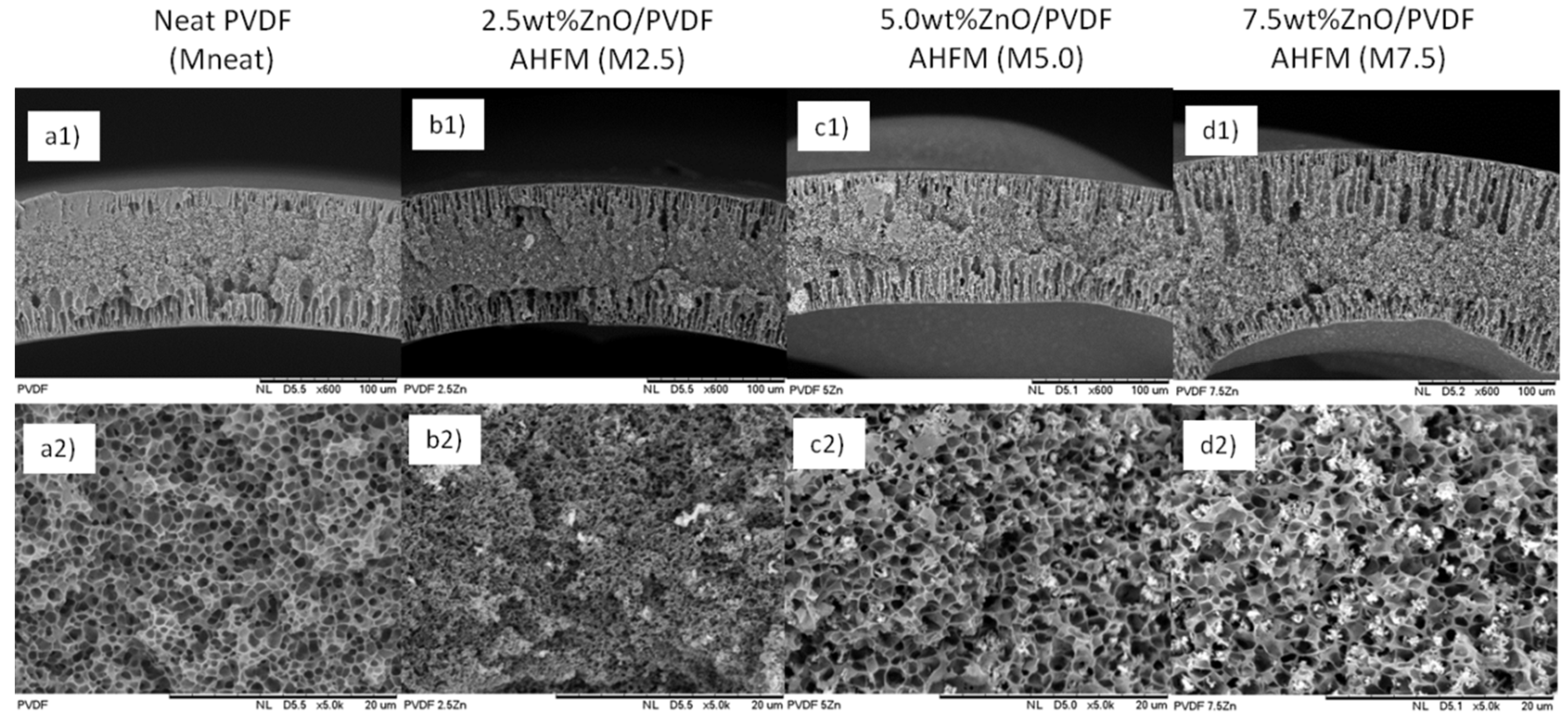 Membranes 12 00110 g001 Membranes 12 00110 g001