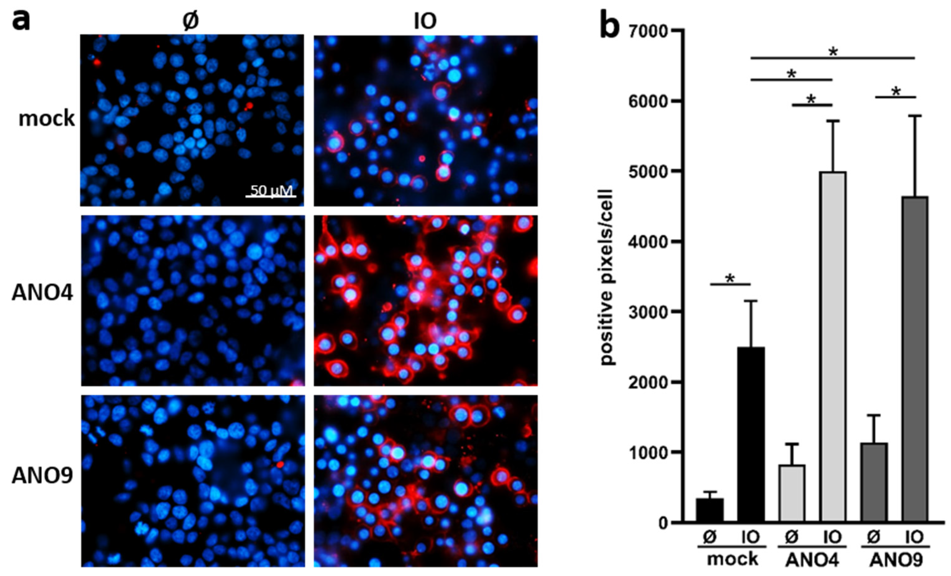 Membranes 12 00123 g004