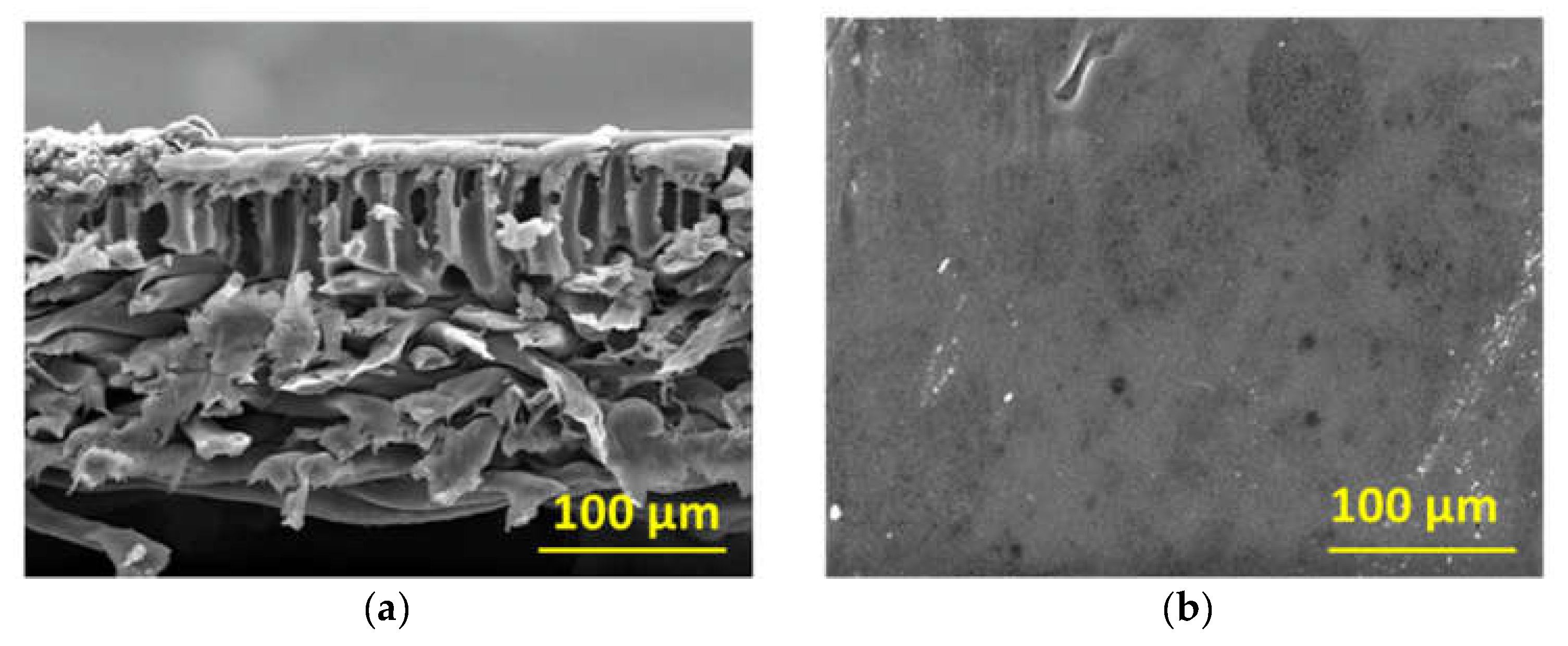 Membranes 12 00129 g003
