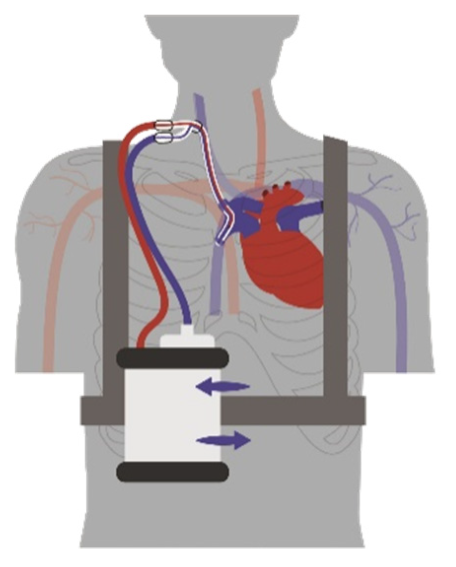 Membranes 12 00133 g001 Membranes 12 00133 g001