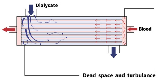 Membranes Free Full Text Artificial Kidney Engineering The Development Of Dialysis Membranes For Blood Purification Html