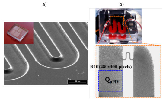 Microfluidics Approach to the Mechanical Properties of Red Blood Cell ...