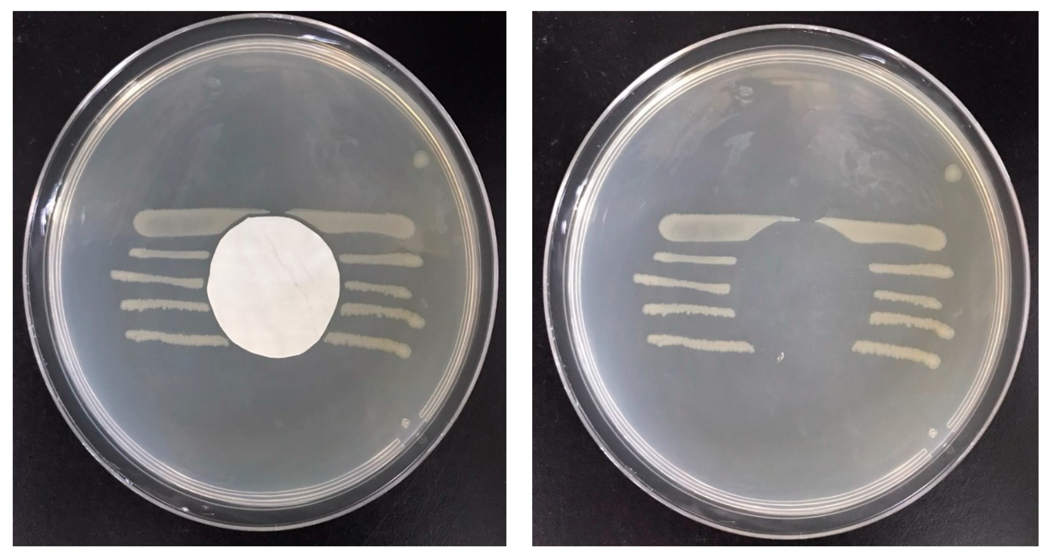 Membranes 12 00332 g010