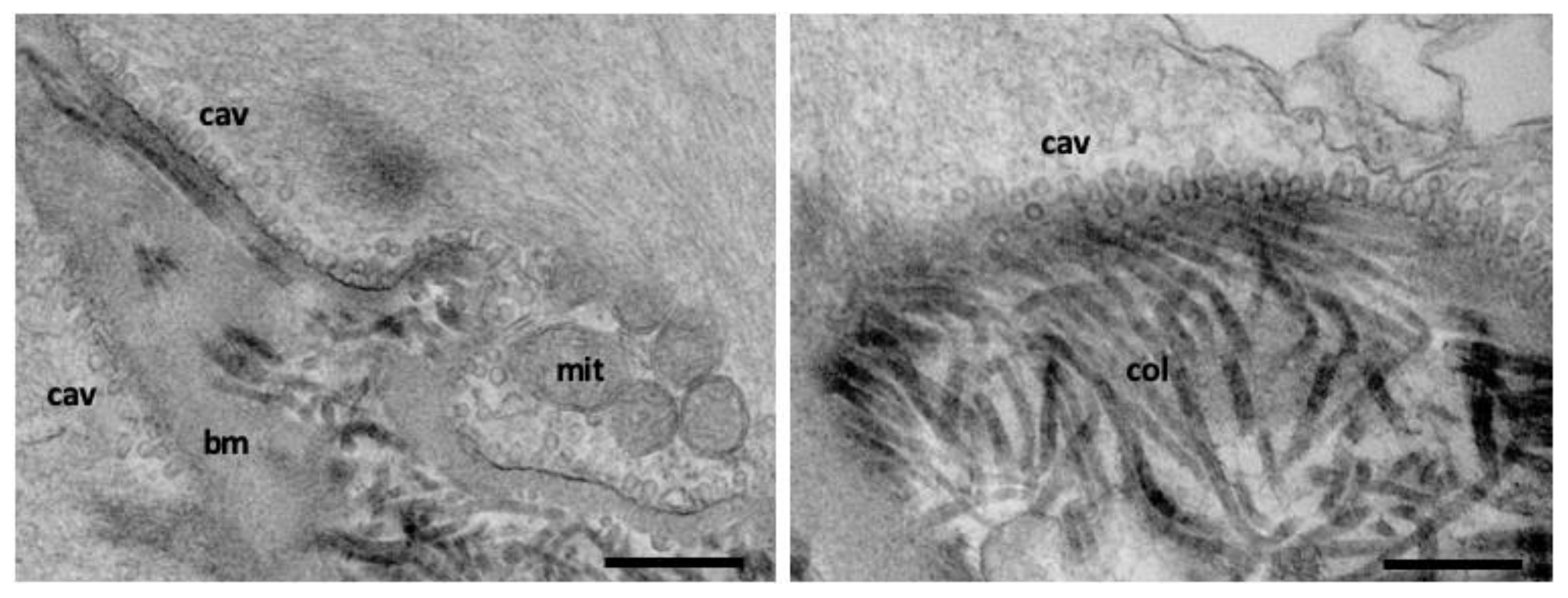 Membranes 12 00393 g003