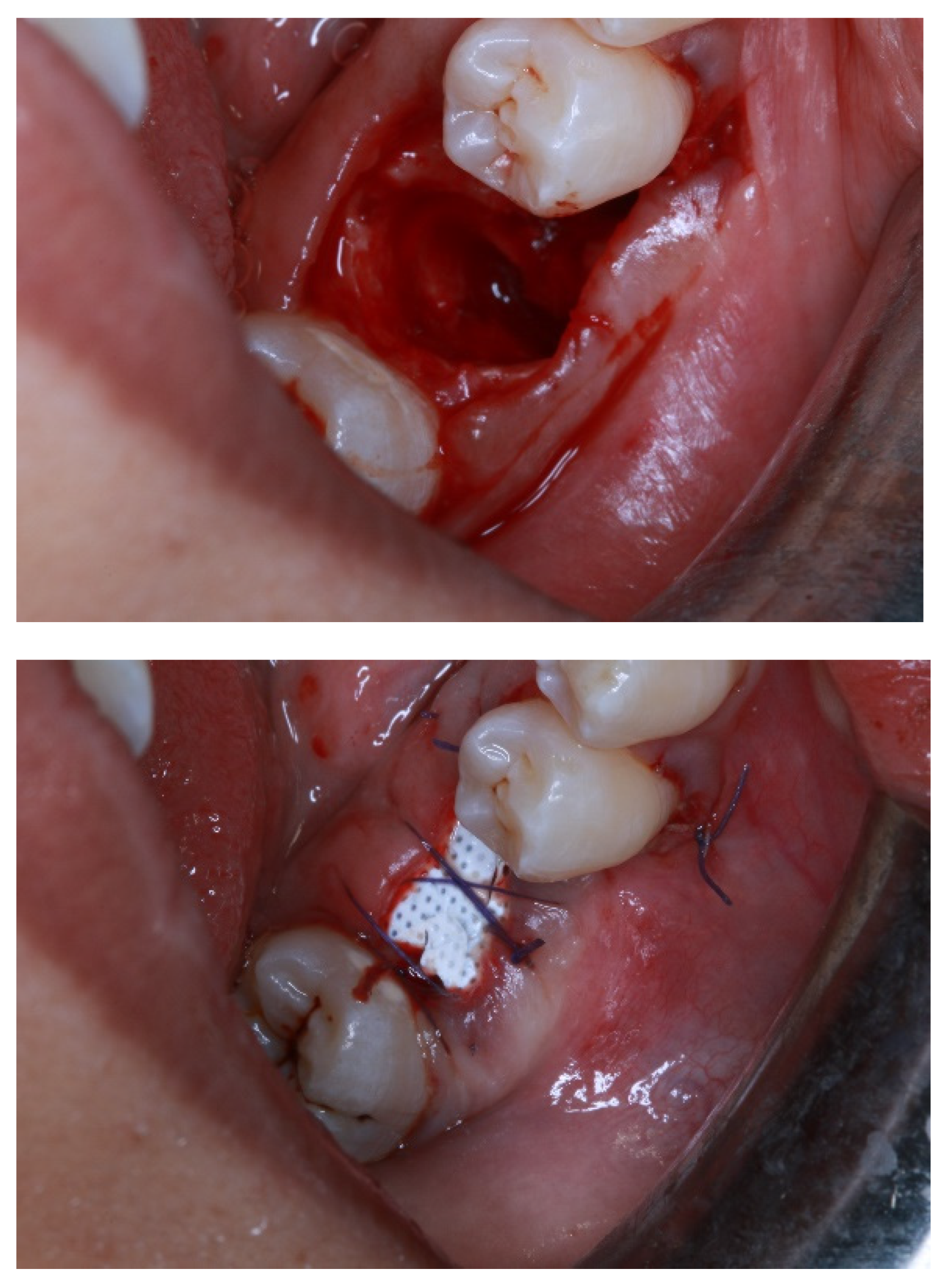 Membranes 12 00444 g002a