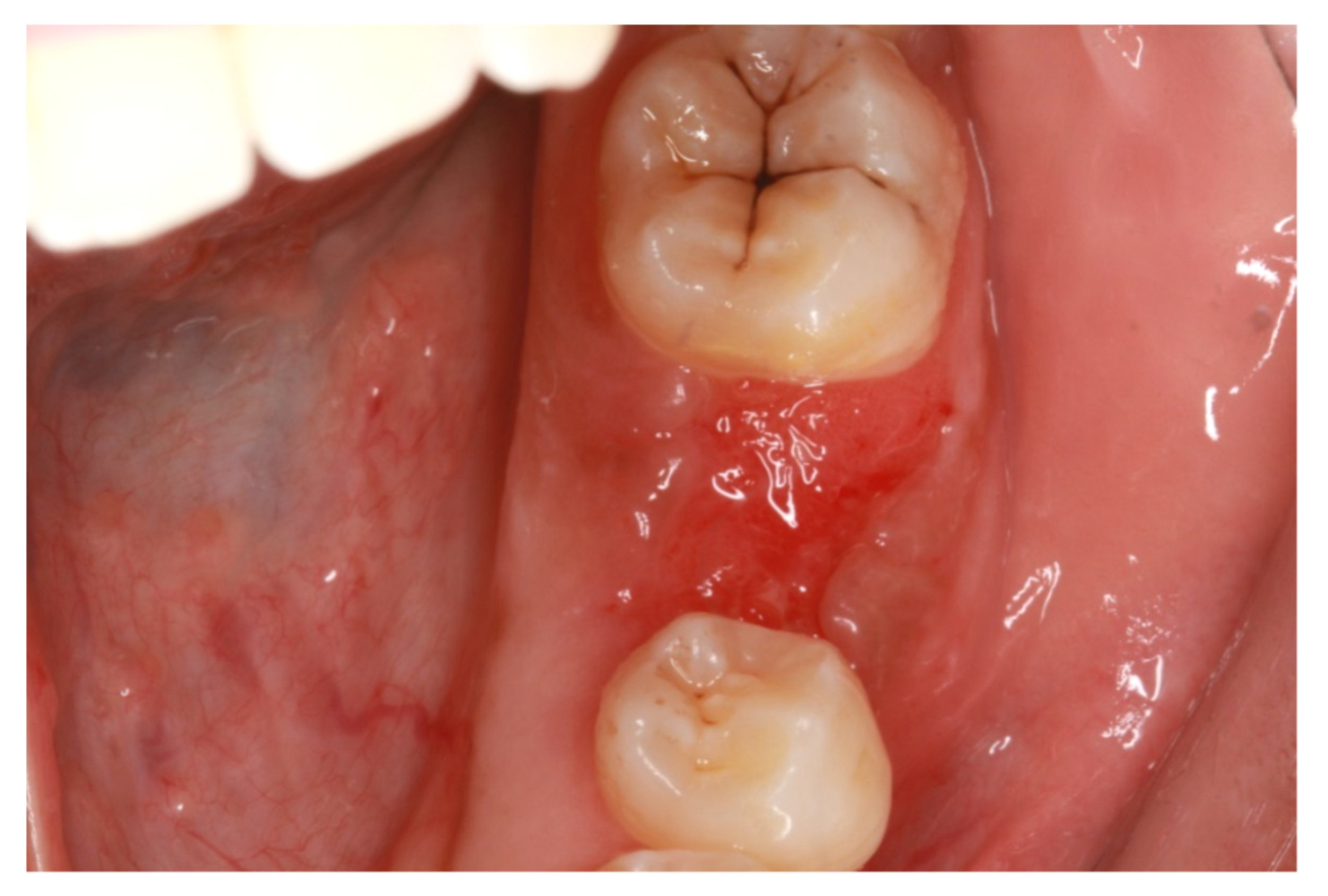 Membranes 12 00444 g002b