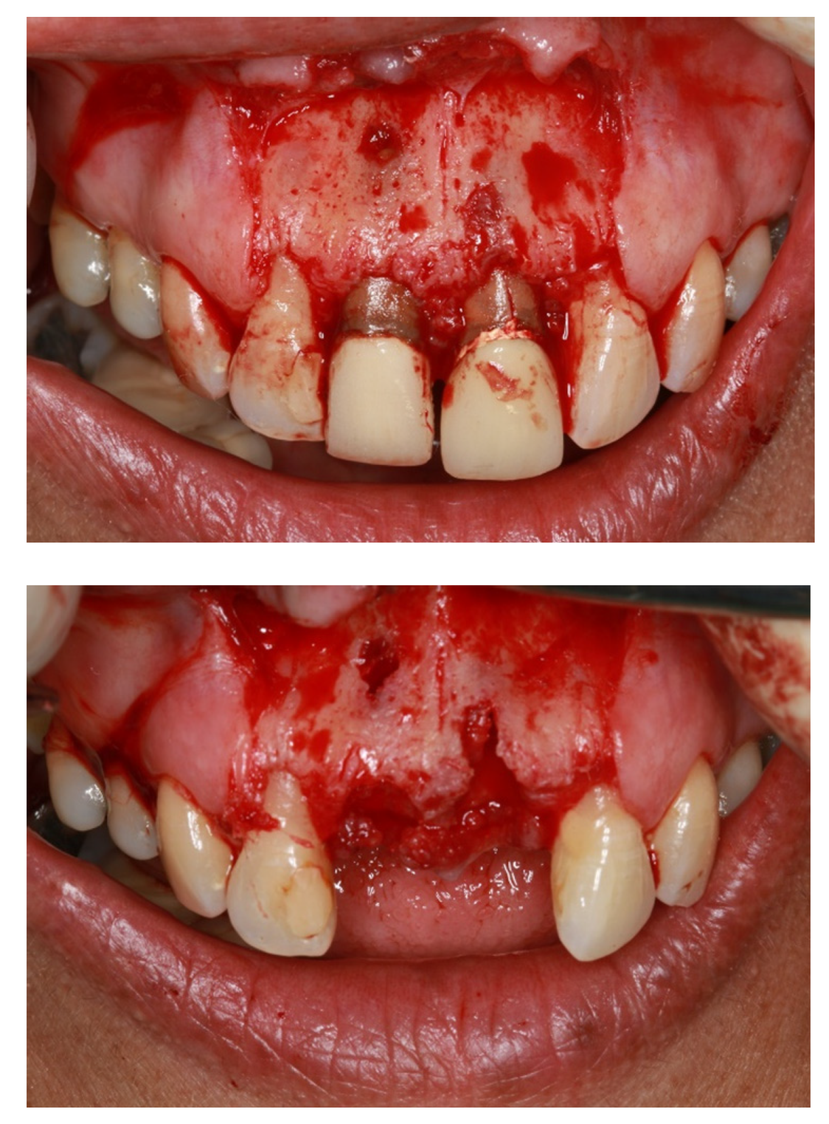 Membranes 12 00444 g003a