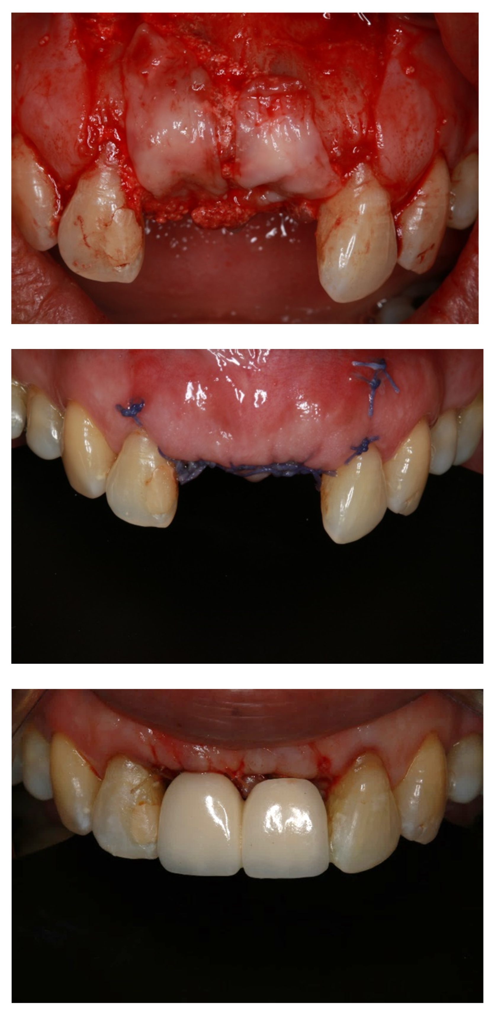 Membranes 12 00444 g003b