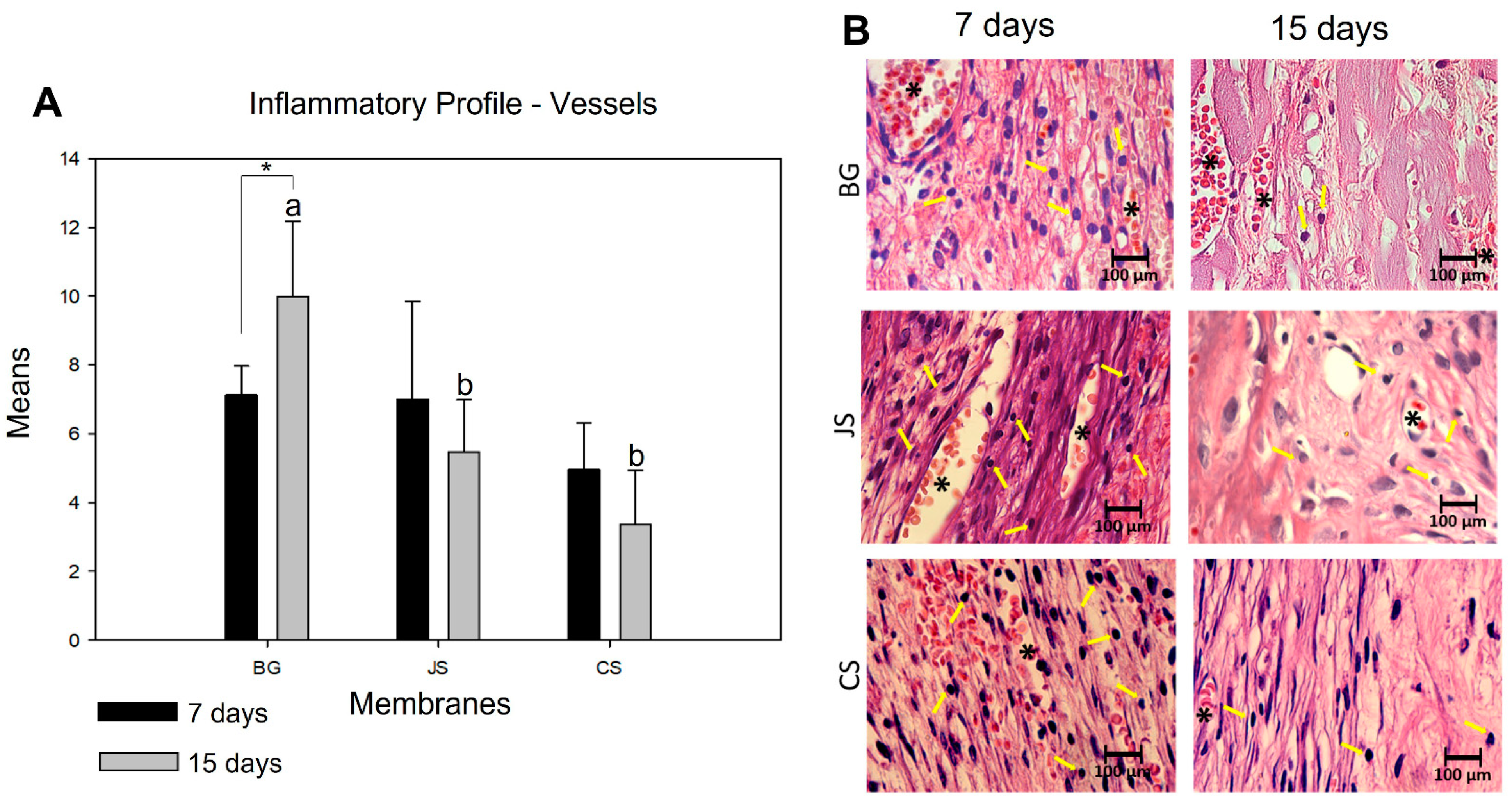 Membranes 12 00461 g005
